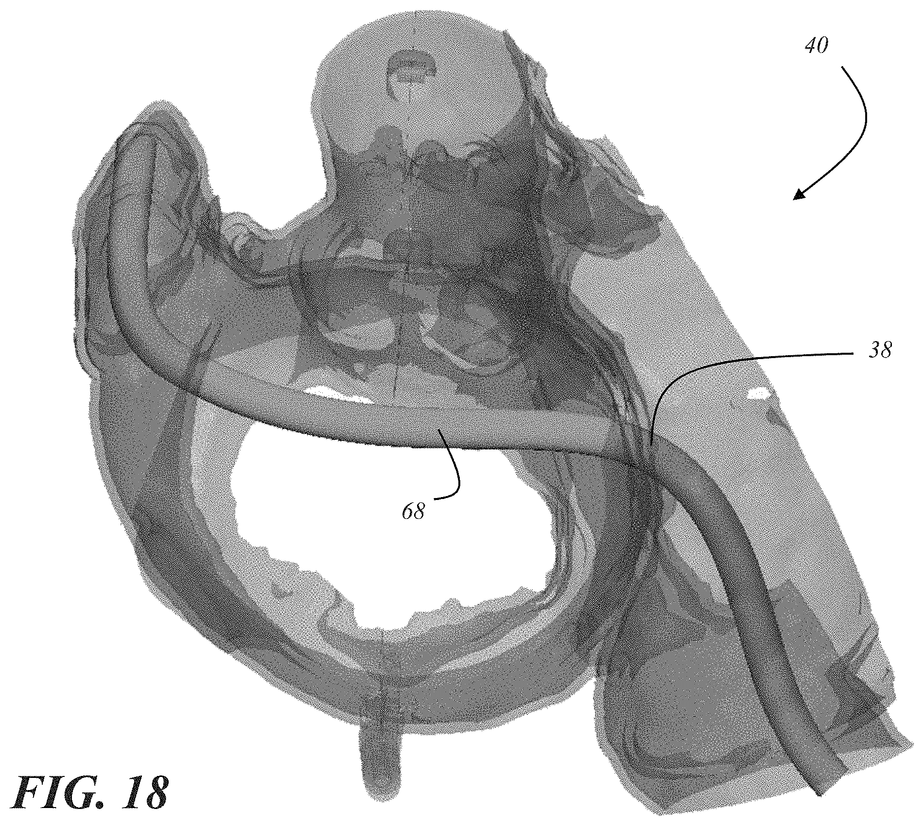 Patent US11793572 Figure 18 – Selecting a medical device for use in a medical procedure
