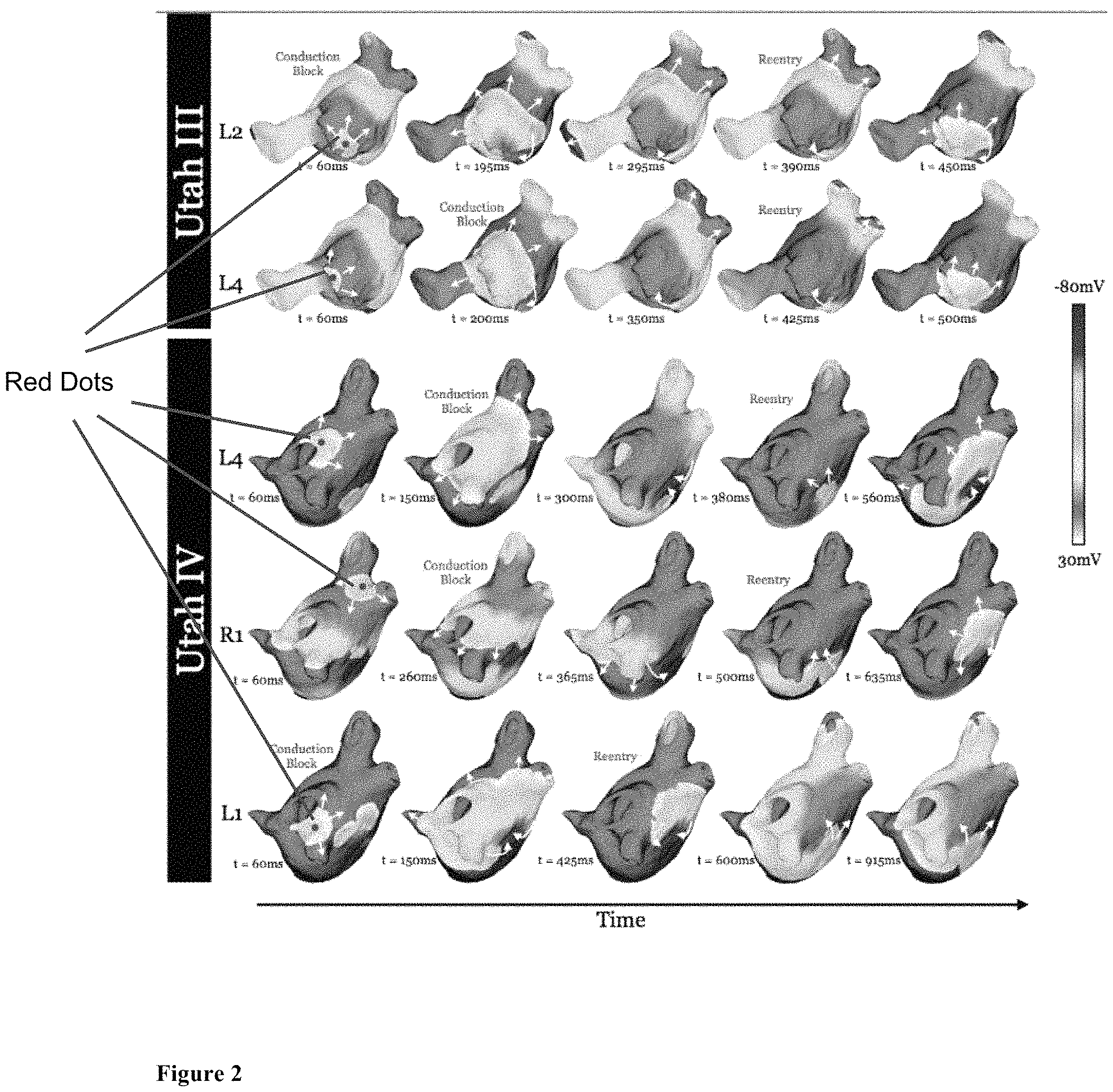 Patent US11793573 Figure 2 – Personalized computation modeling of atrial fibrosis to guide catheter ablation of atrial fibrillation