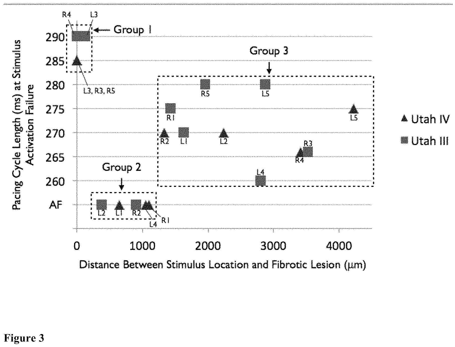 Patent US11793573 Figure 3 – Personalized computation modeling of atrial fibrosis to guide catheter ablation of atrial fibrillation