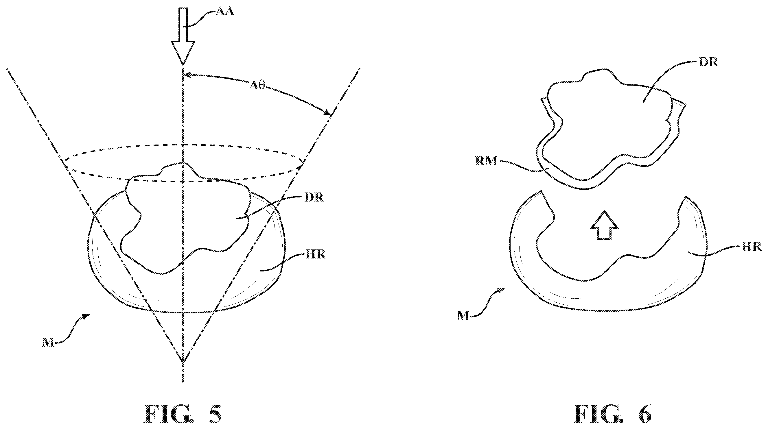 Patent US11793574 Figure 3 – Automated cut planning for removal of diseased regions