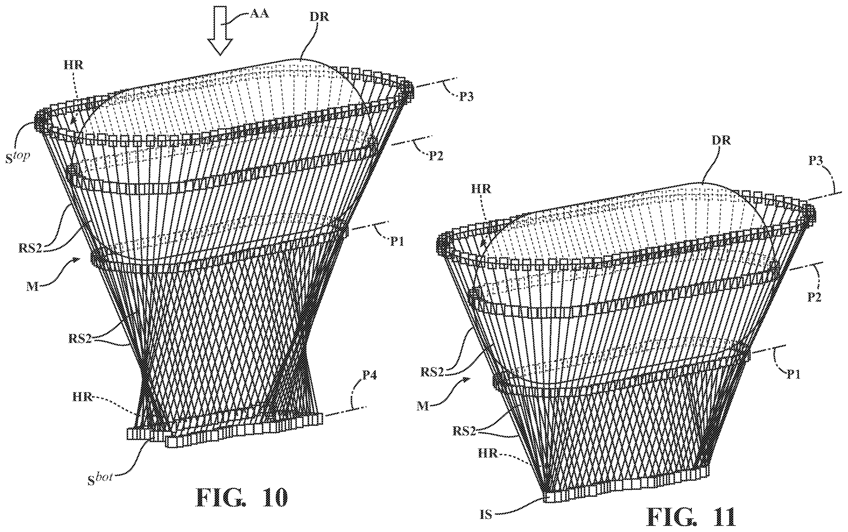 Patent US11793574 Figure 7 – Automated cut planning for removal of diseased regions
