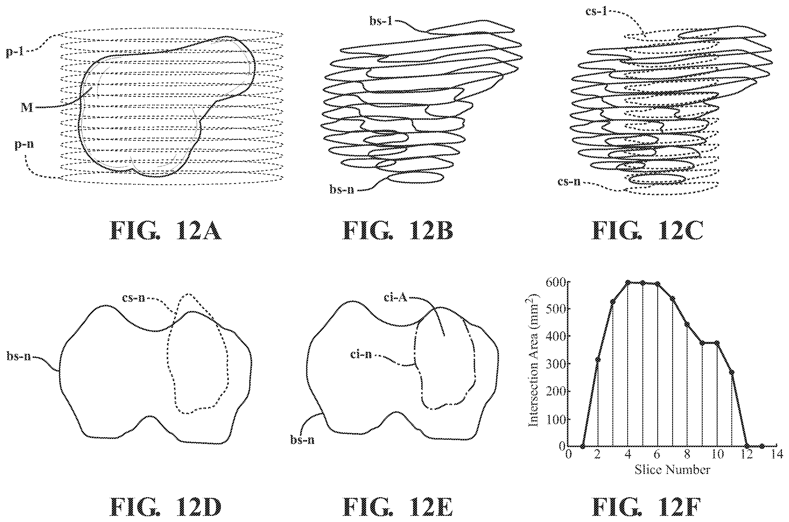 Patent US11793574 Figure 8 – Automated cut planning for removal of diseased regions