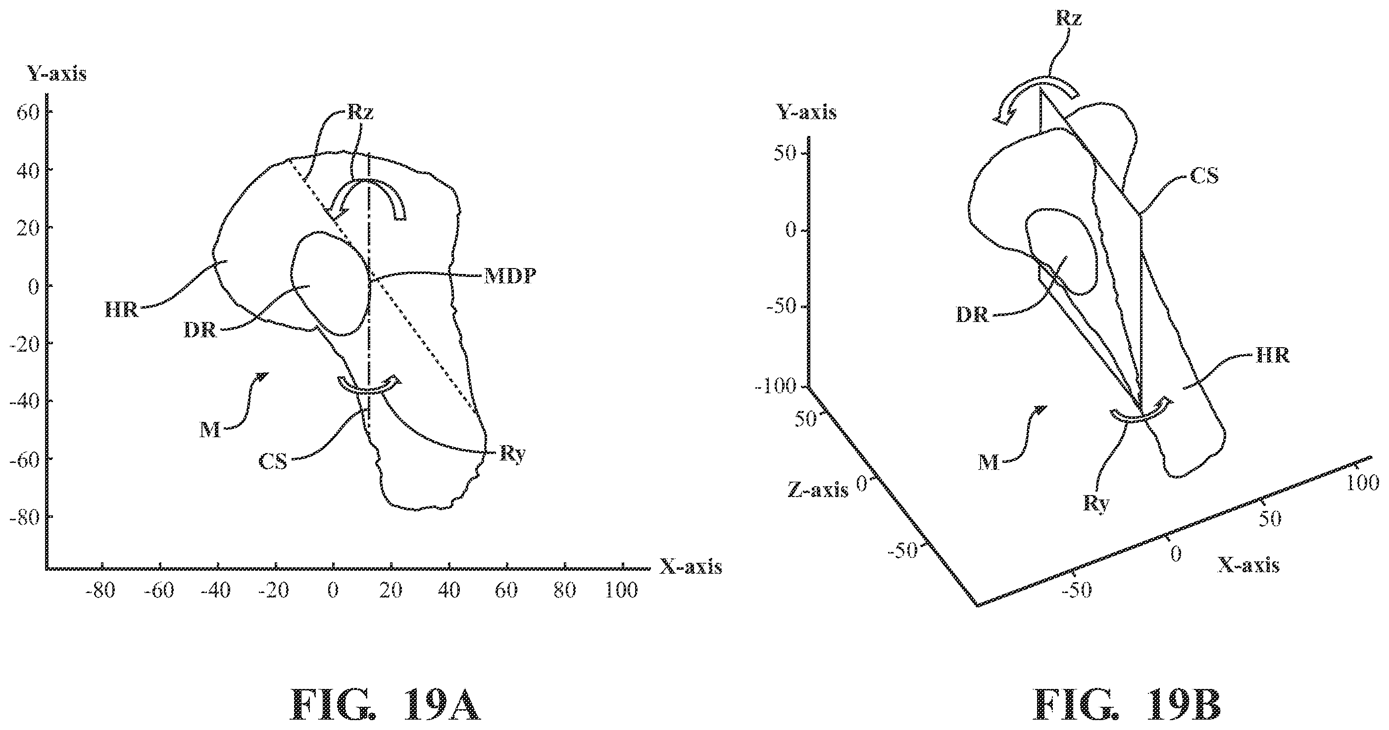 Patent US11793574 Figure 12 – Automated cut planning for removal of diseased regions