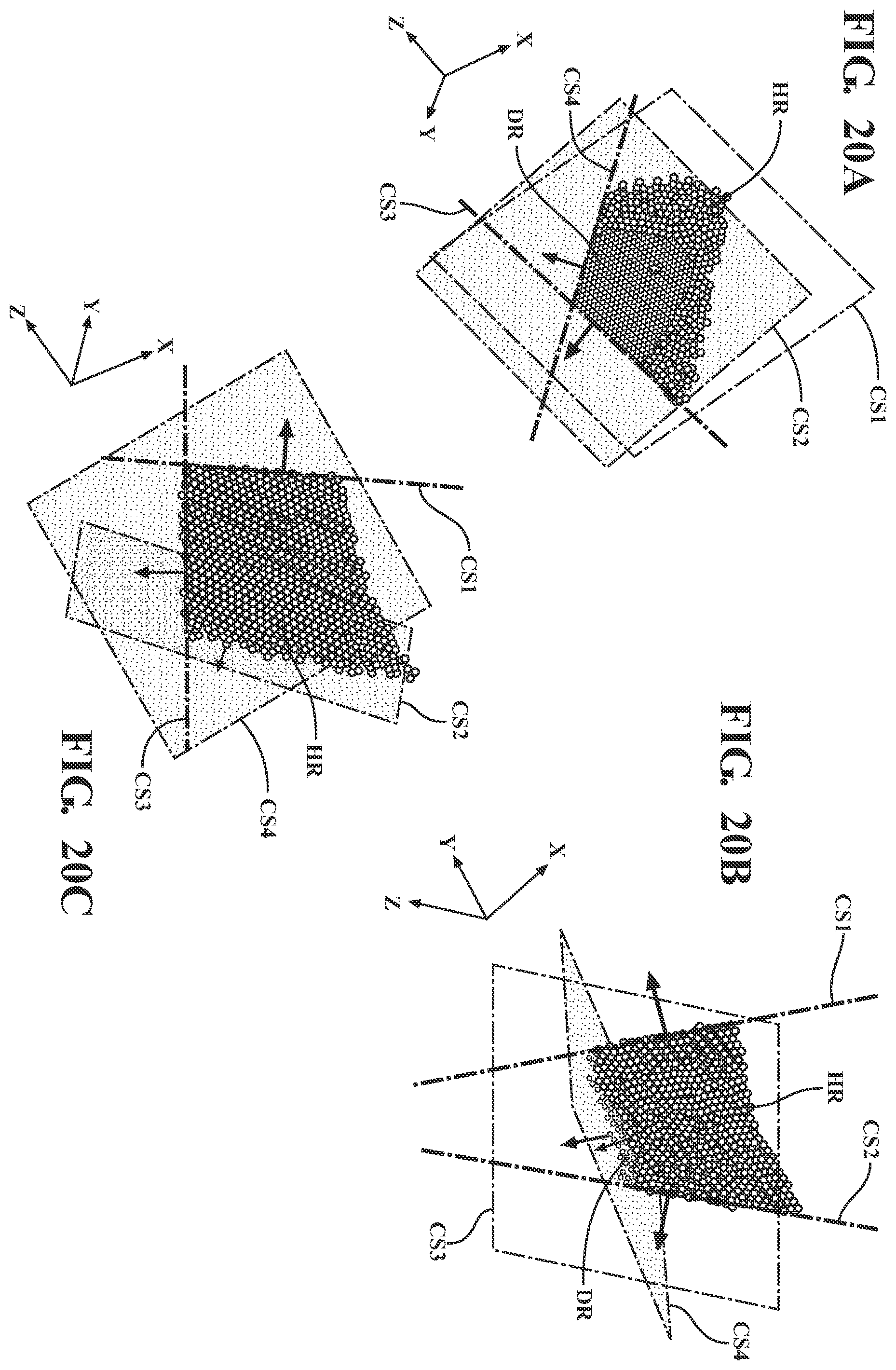 Patent US11793574 Figure 13 – Automated cut planning for removal of diseased regions