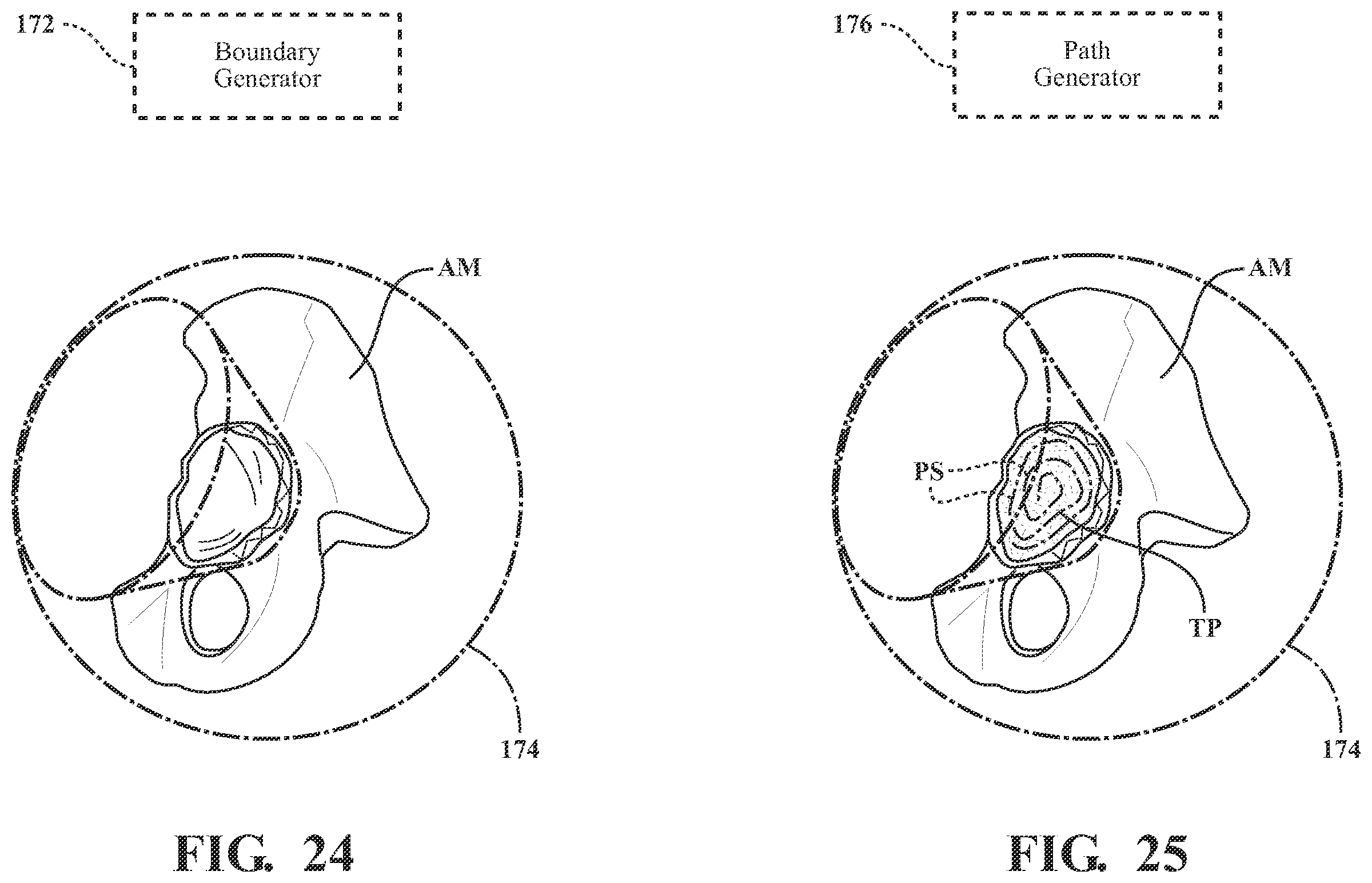 Patent US11793574 Figure 17 – Automated cut planning for removal of diseased regions