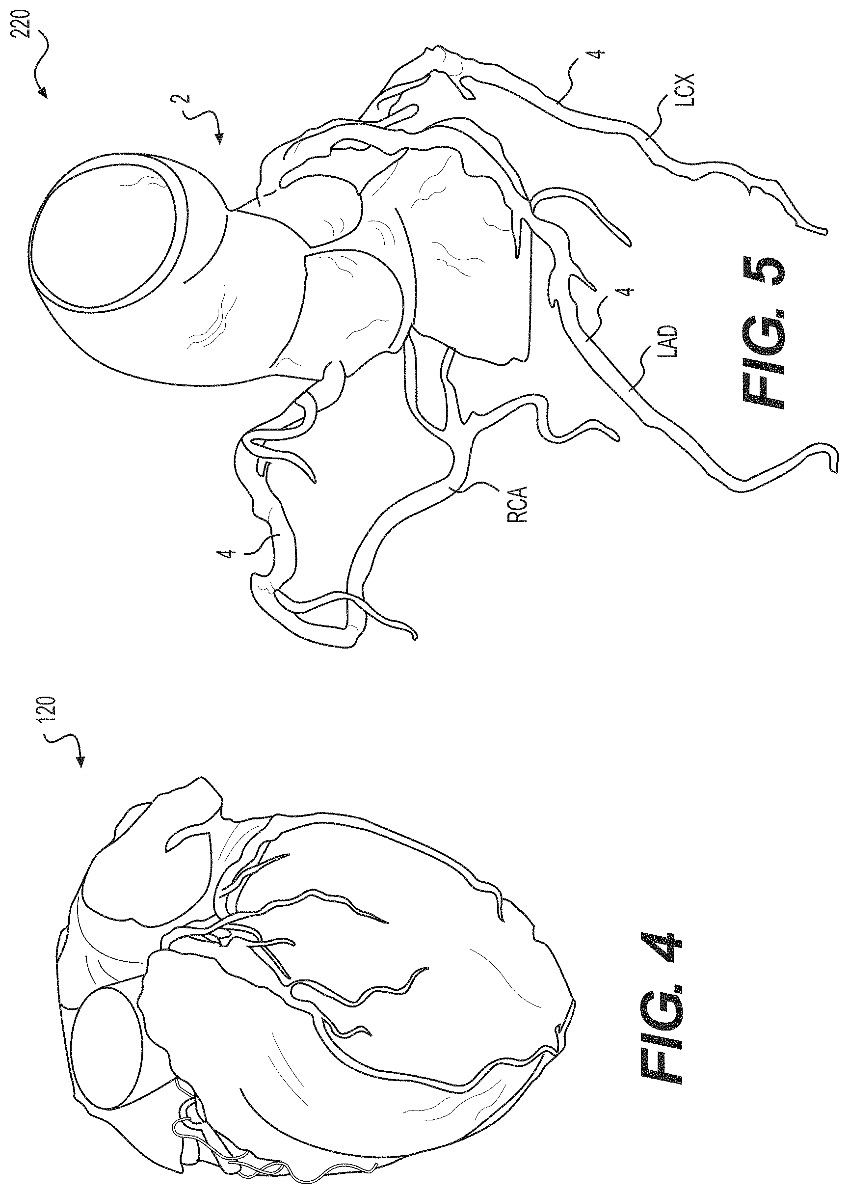 Patent US11793575 Figure 4 – Method and system for image processing to determine blood flow