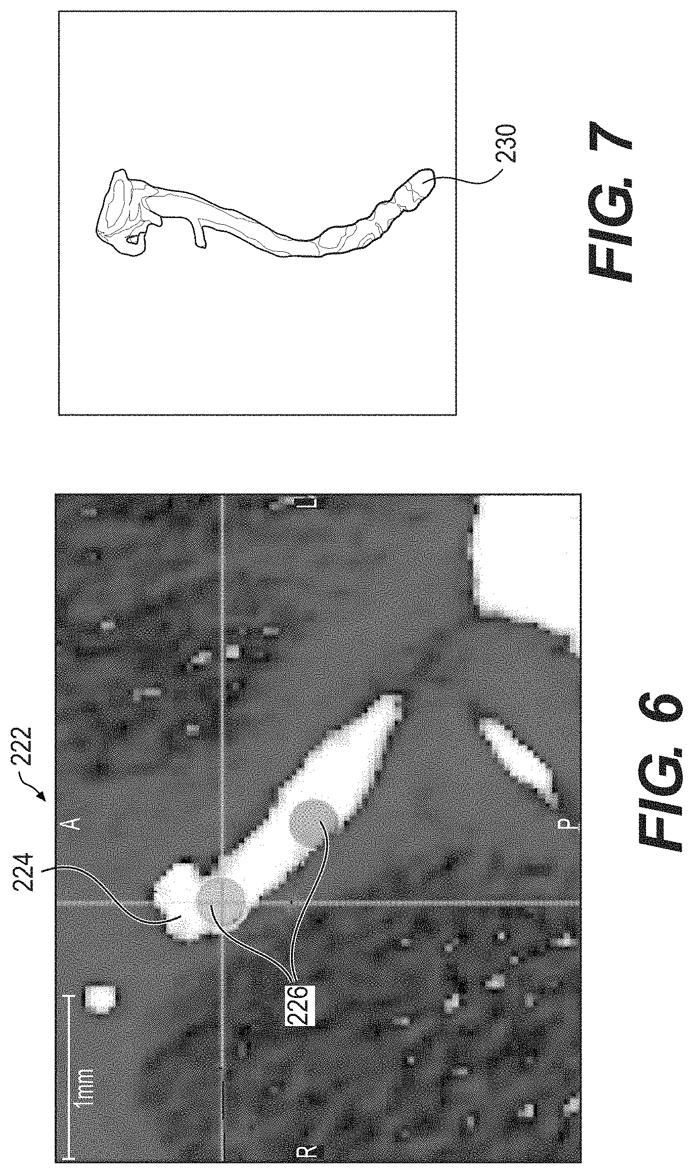 Patent US11793575 Figure 5 – Method and system for image processing to determine blood flow