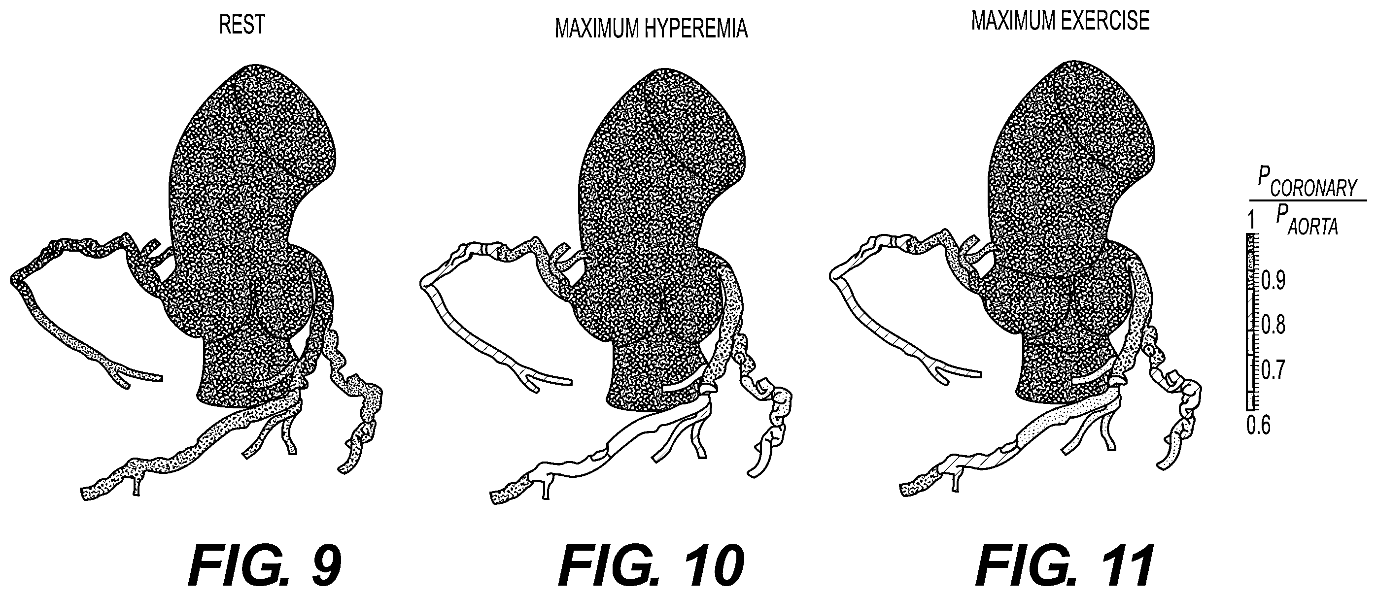 Patent US11793575 Figure 7 – Method and system for image processing to determine blood flow