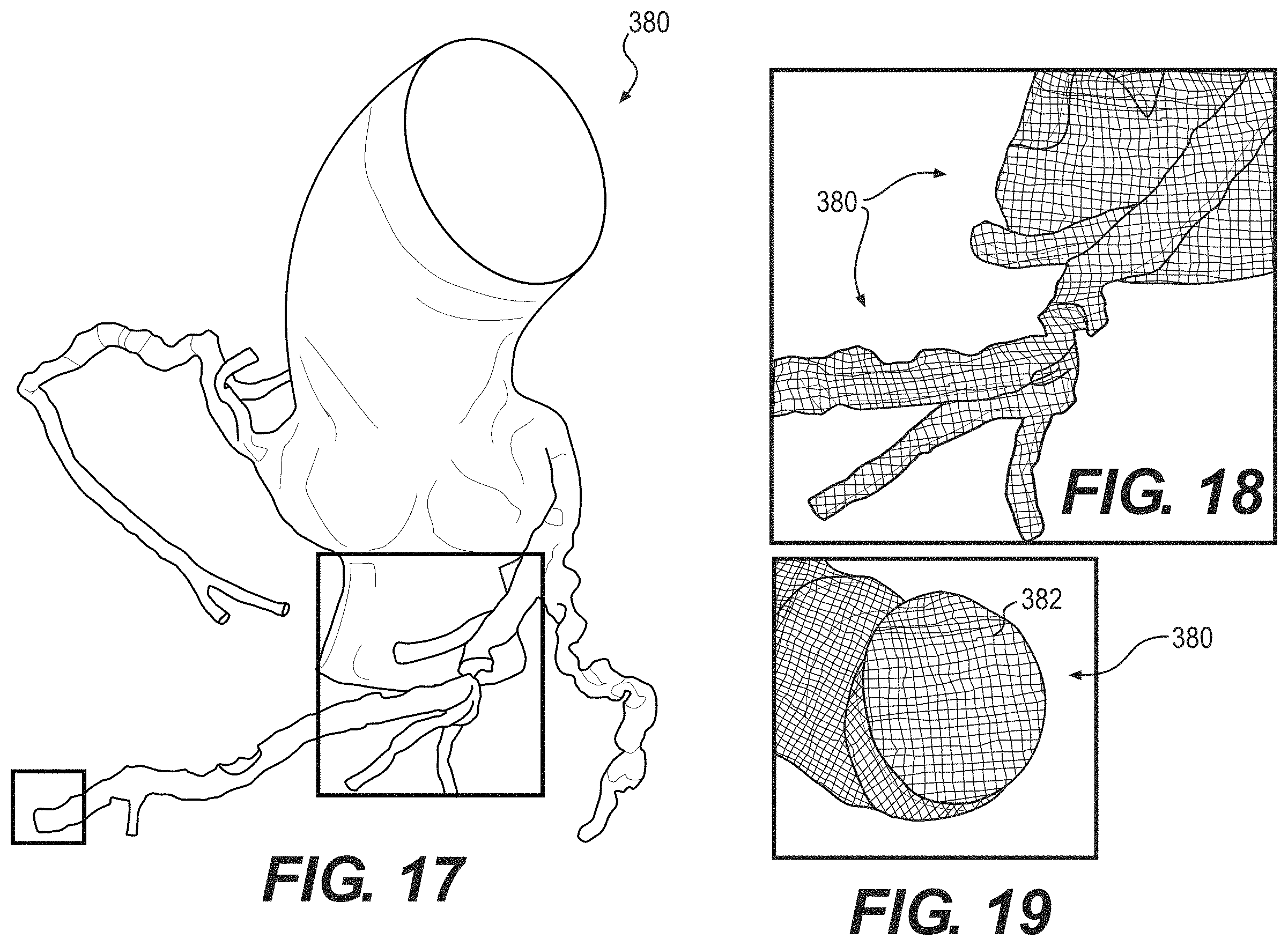 Patent US11793575 Figure 10 – Method and system for image processing to determine blood flow