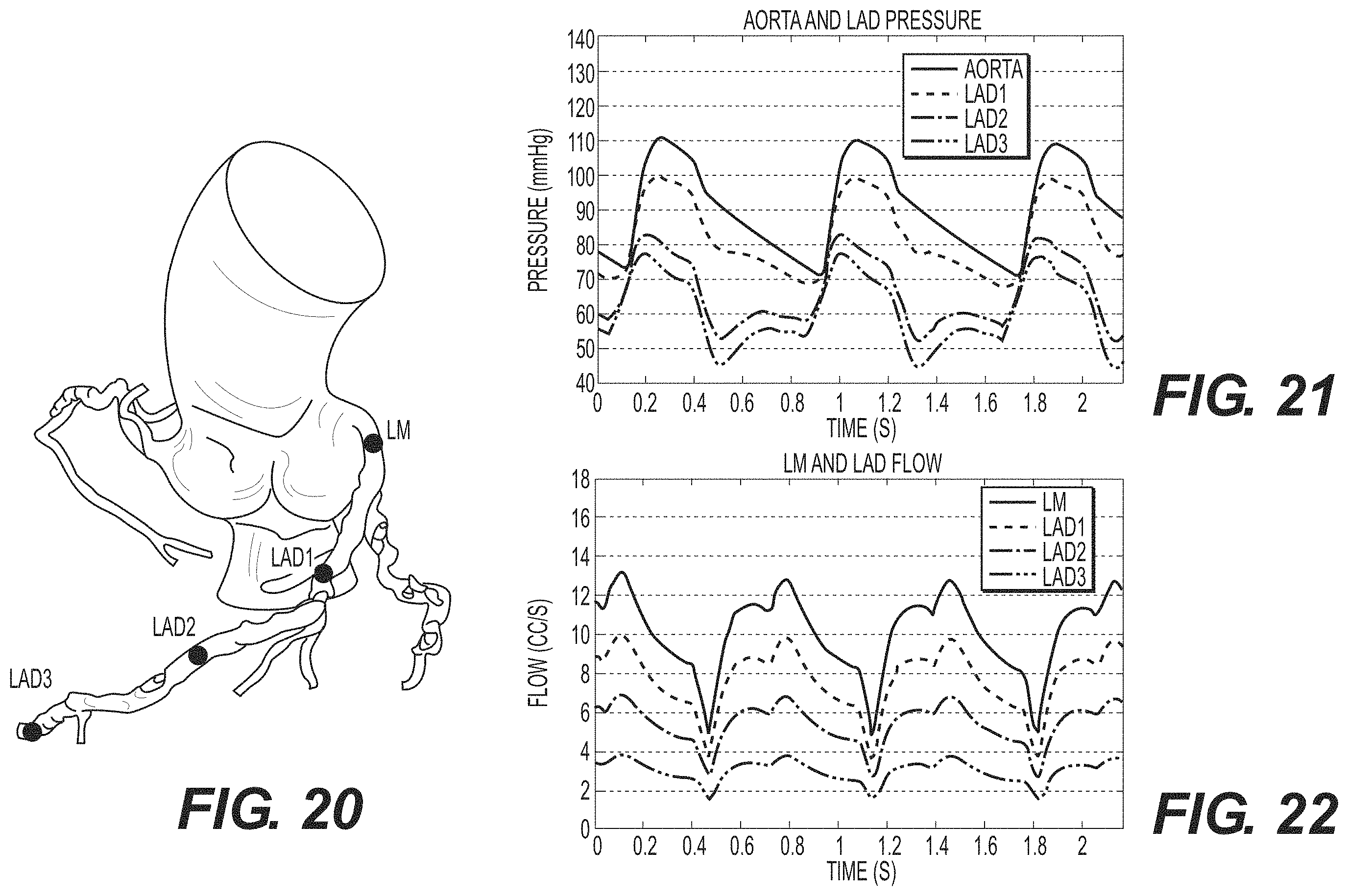 Patent US11793575 Figure 11 – Method and system for image processing to determine blood flow