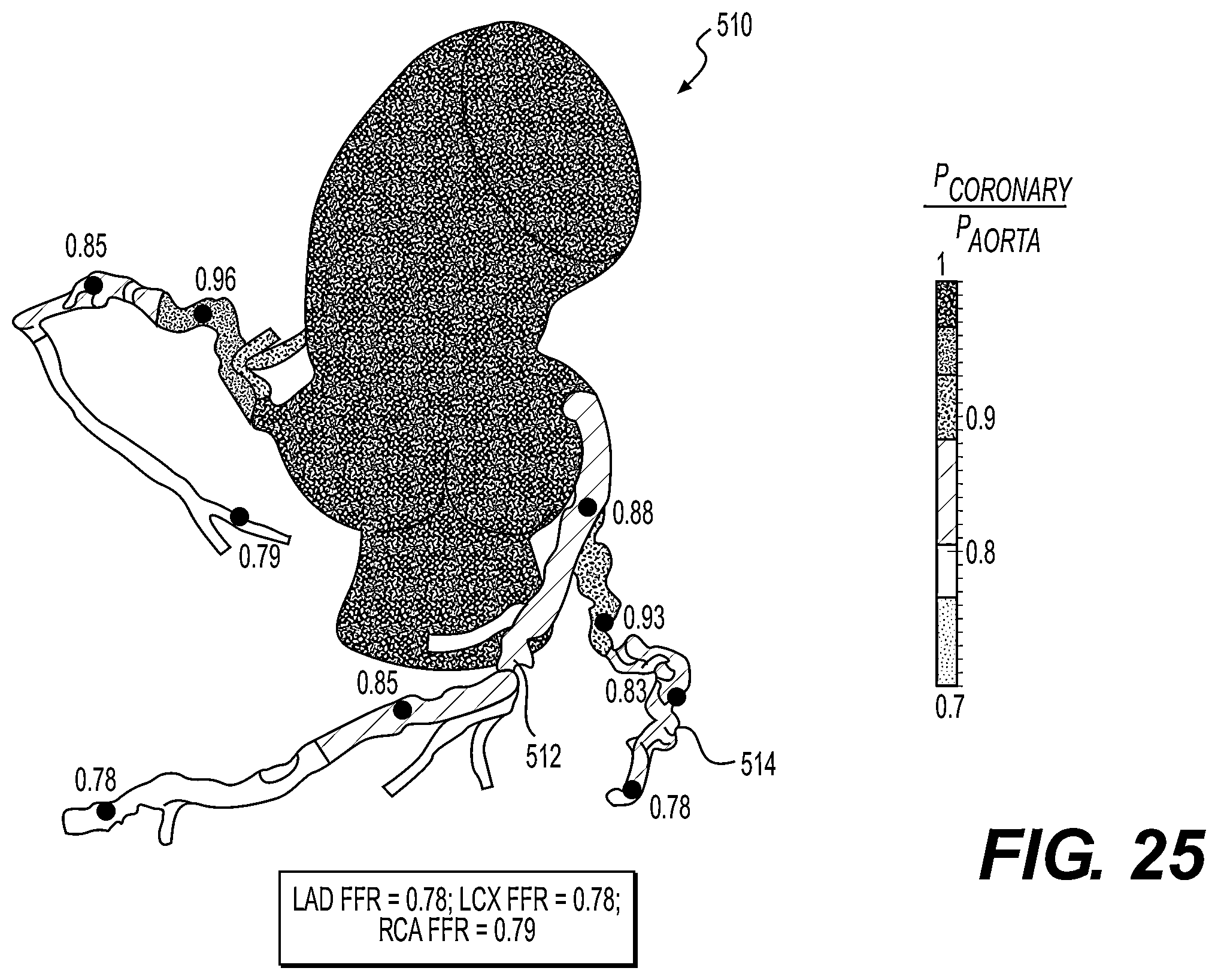Patent US11793575 Figure 14 – Method and system for image processing to determine blood flow