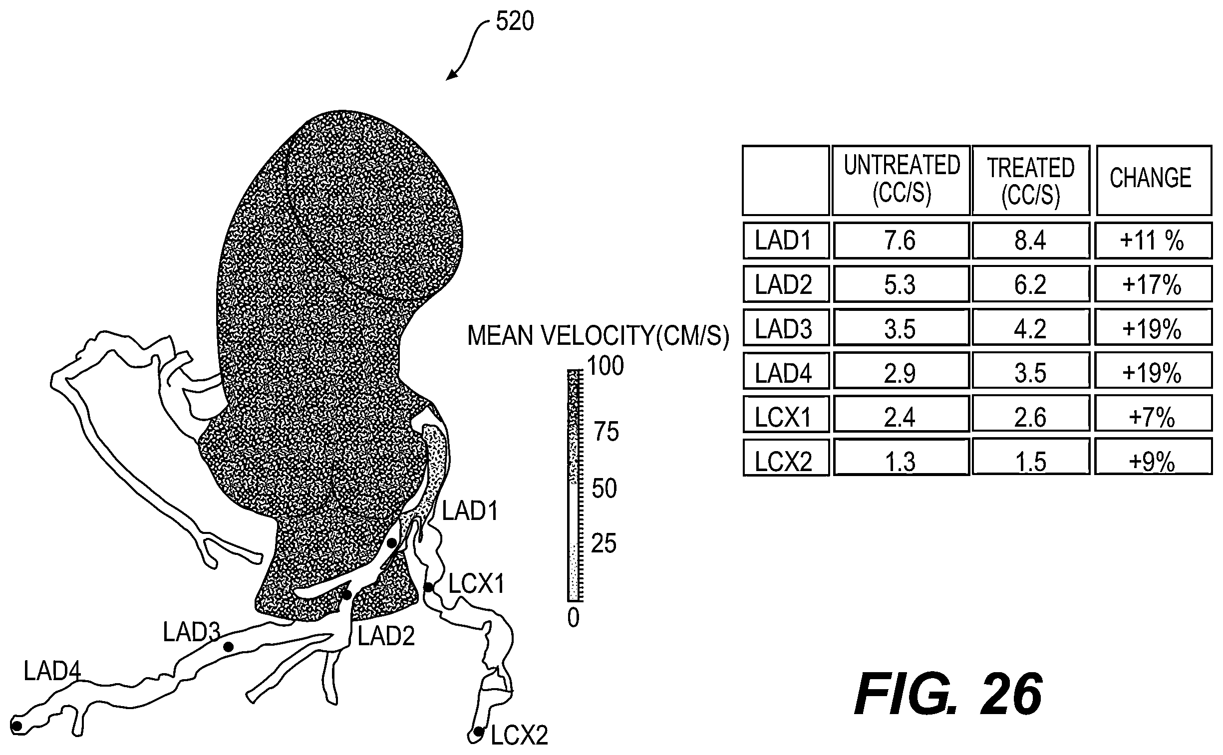 Patent US11793575 Figure 15 – Method and system for image processing to determine blood flow