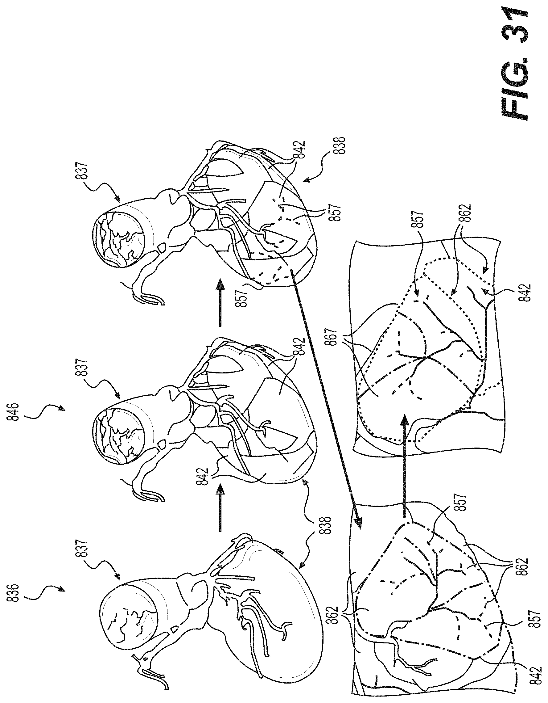 Patent US11793575 Figure 20 – Method and system for image processing to determine blood flow