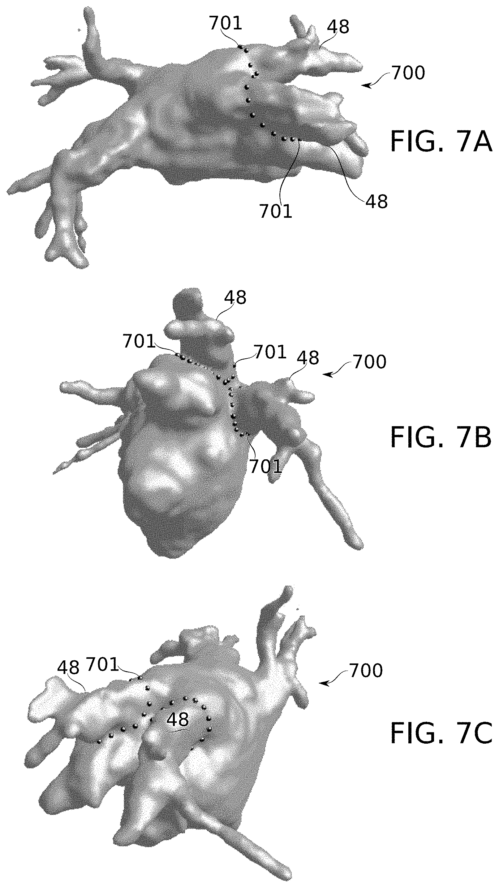 Patent US11793576 Figure 8 – Calculation of an ablation plan
