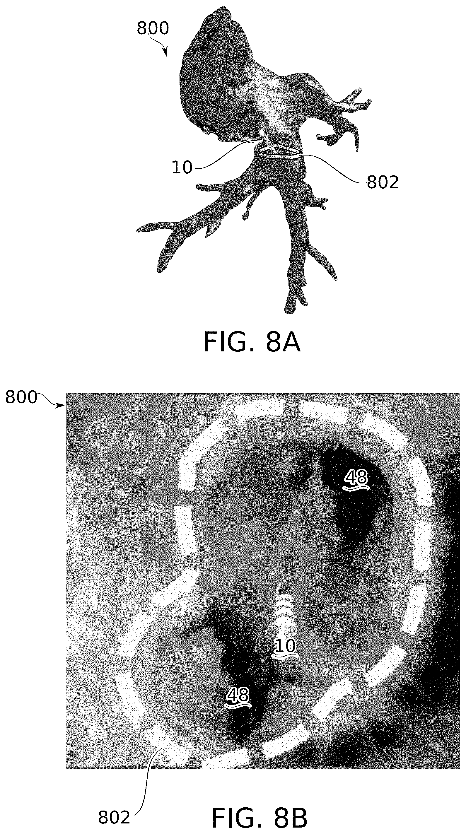 Patent US11793576 Figure 9 – Calculation of an ablation plan
