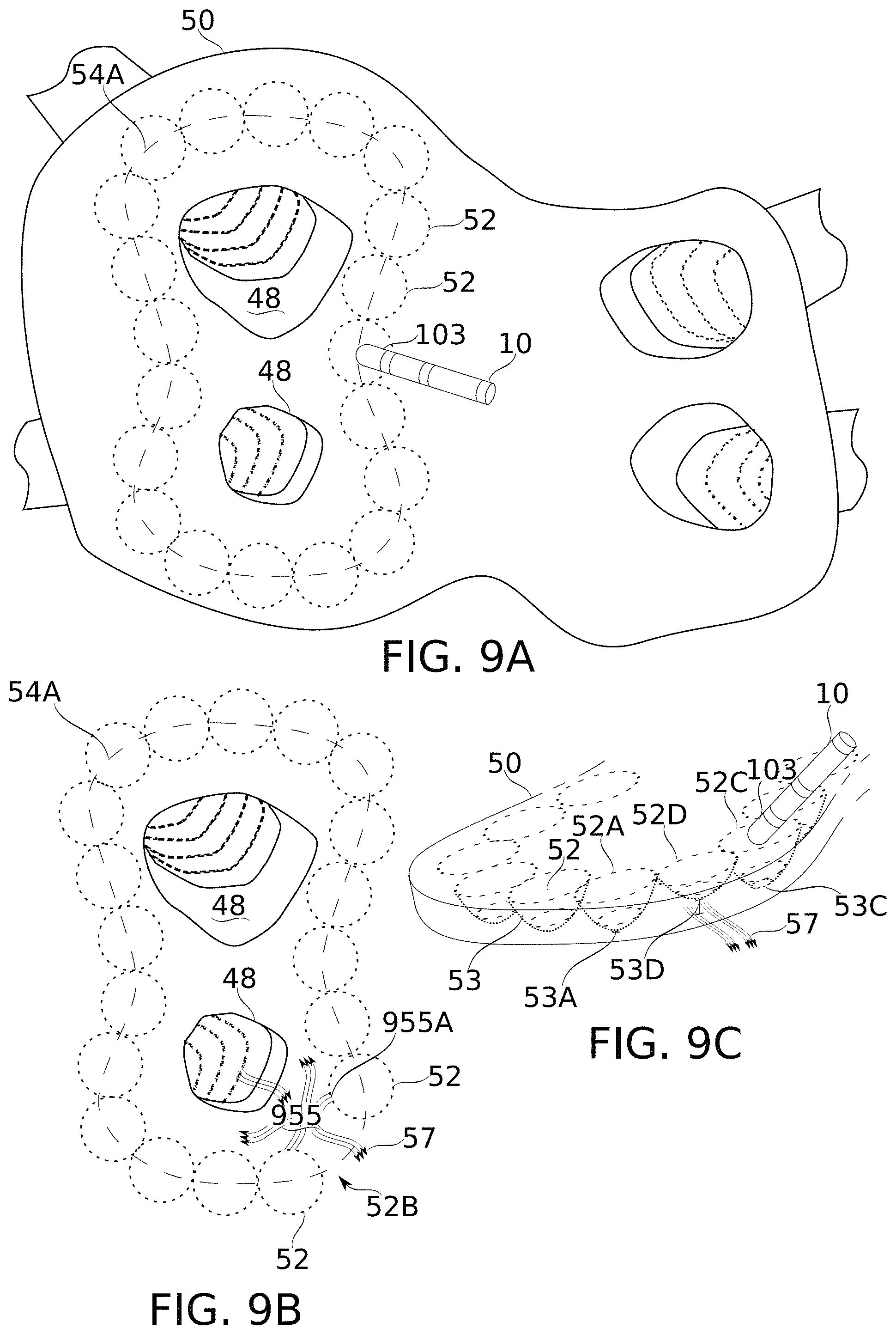 Patent US11793576 Figure 10 – Calculation of an ablation plan