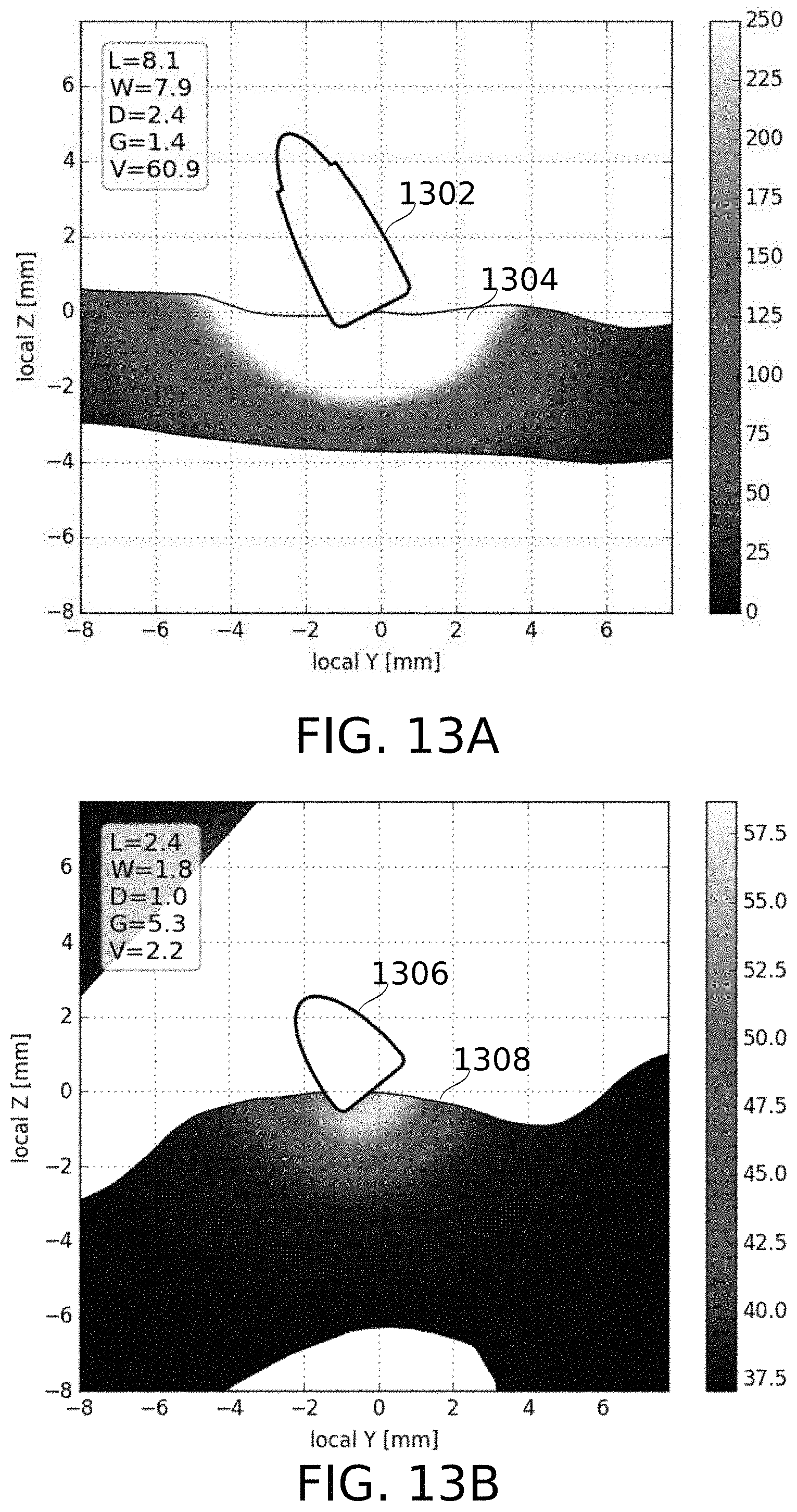 Patent US11793576 Figure 14 – Calculation of an ablation plan