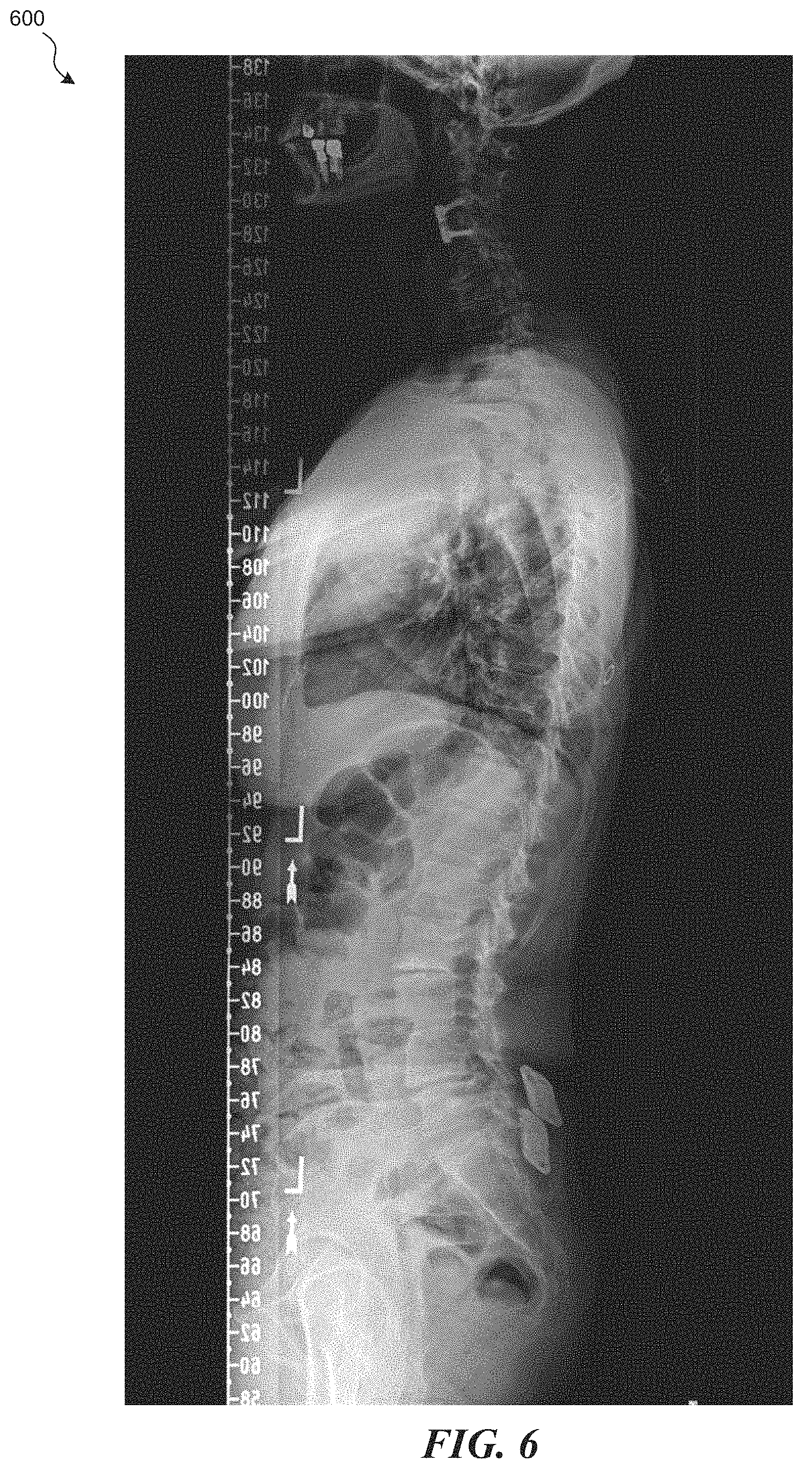 Patent US11793577 Figure 7 – Techniques to map three-dimensional human anatomy data to two-dimensional human anatomy data