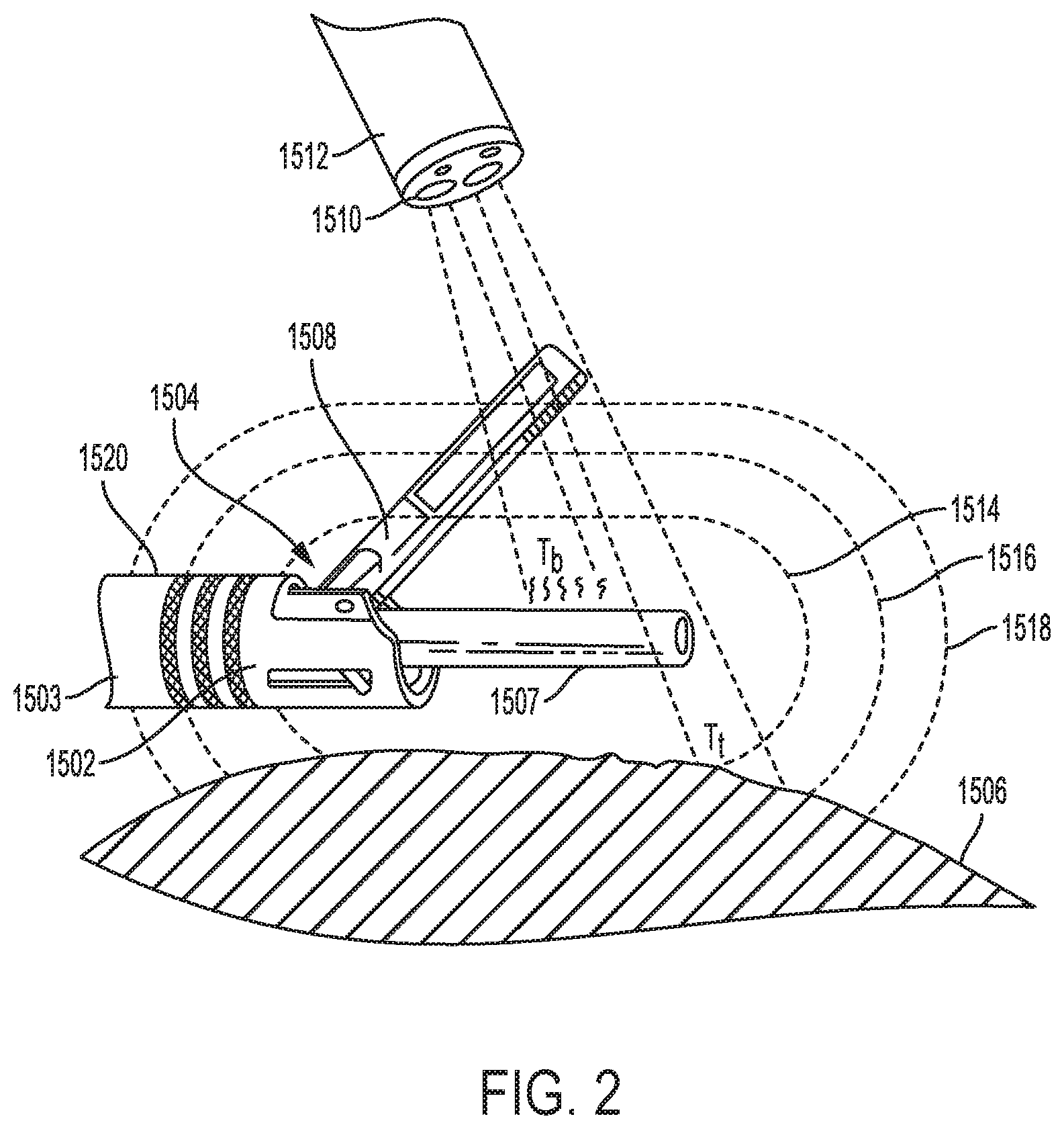 Patent US11793582 Figure 2 – Surgical tool positioning based on sensed parameters