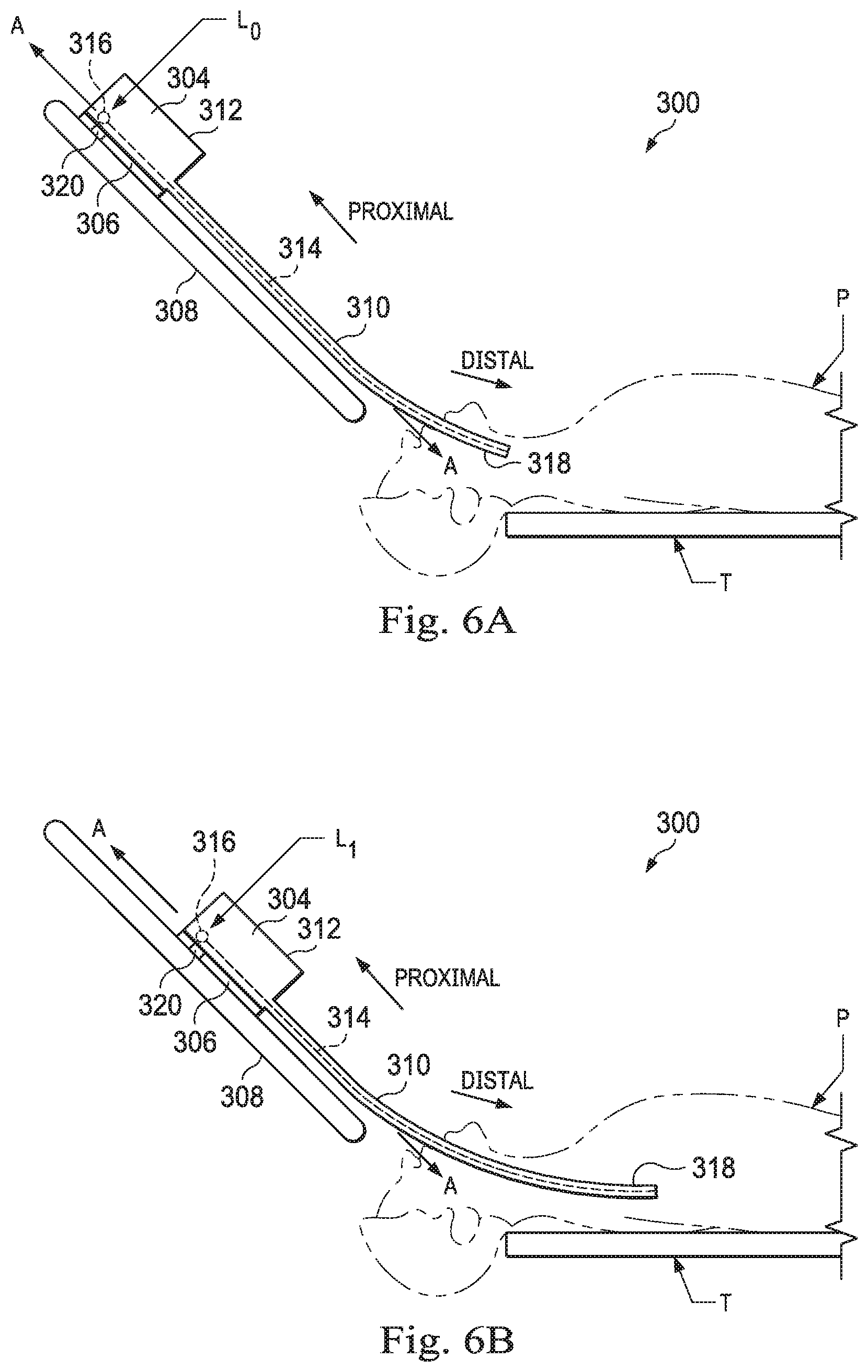 Patent US11793585 Figure 12 – Systems and methods for using a robotic medical system