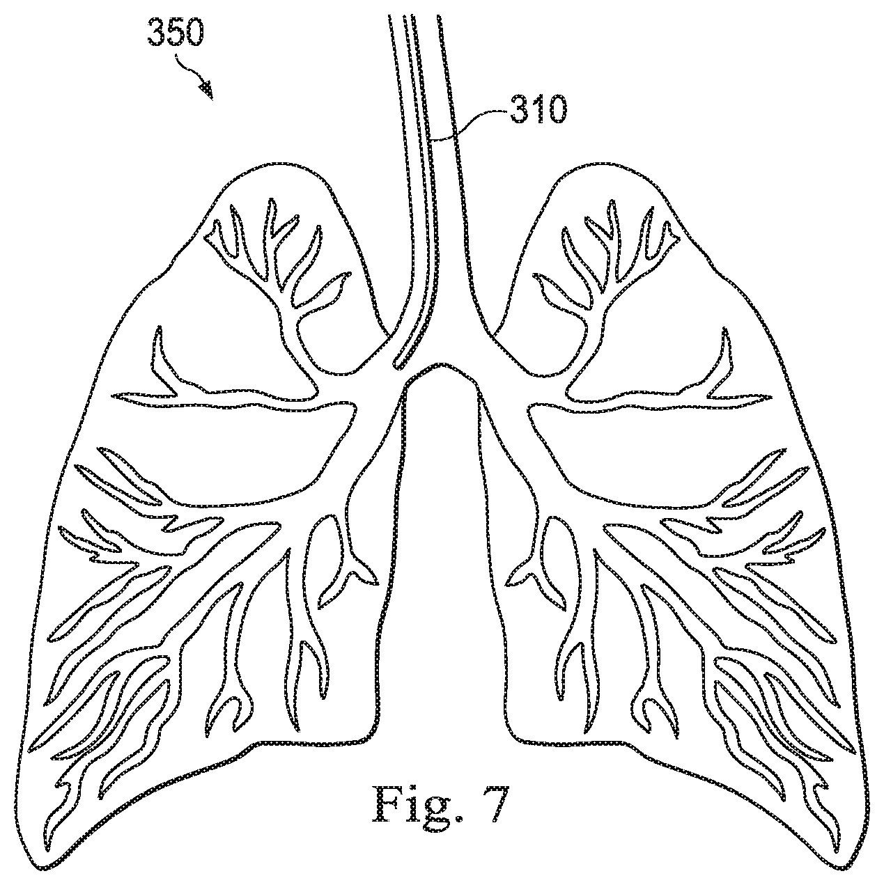 Patent US11793585 Figure 13 – Systems and methods for using a robotic medical system