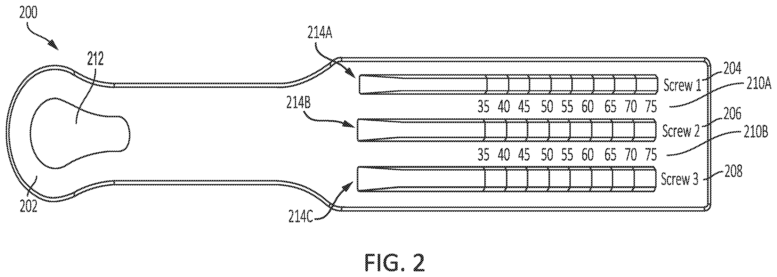 Patent US11793590 Figure 4 – Intramedullary implant screw selection device
