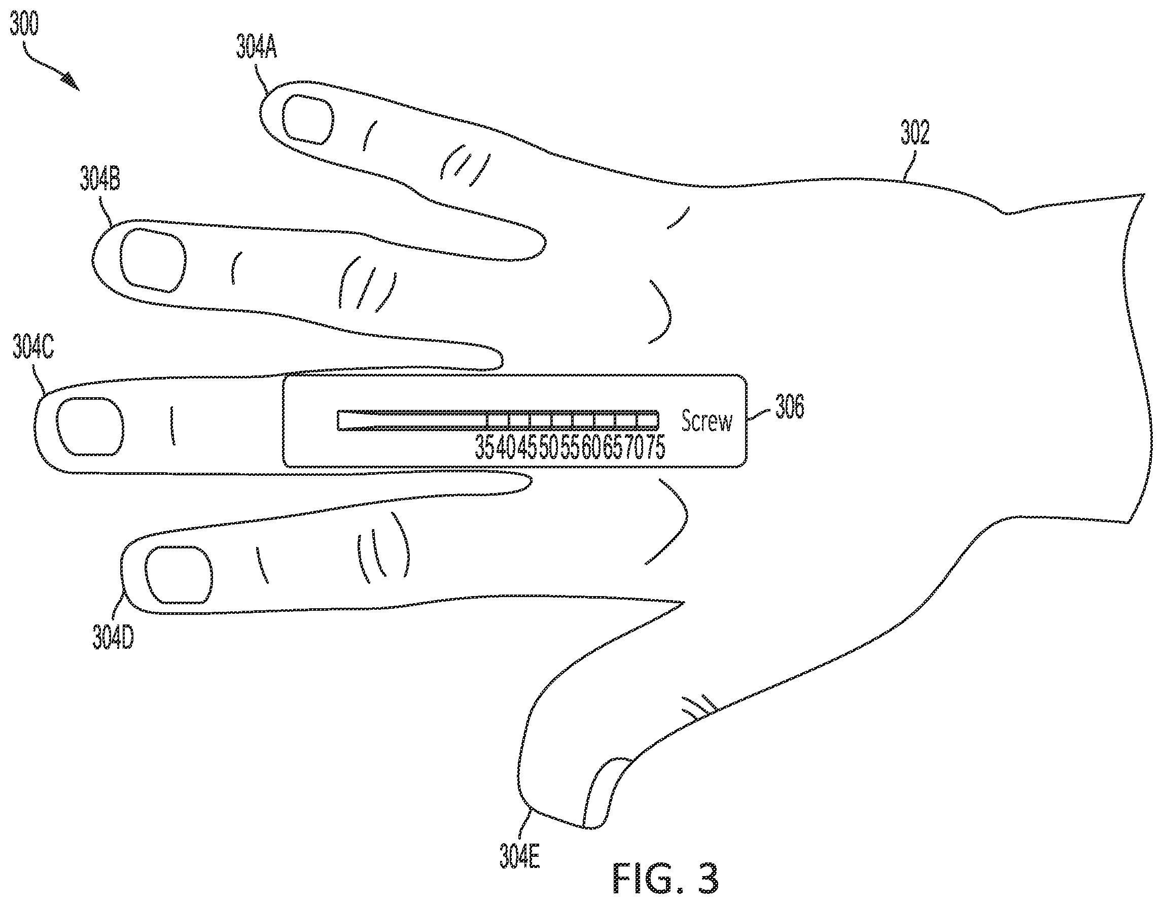 Patent US11793590 Figure 5 – Intramedullary implant screw selection device