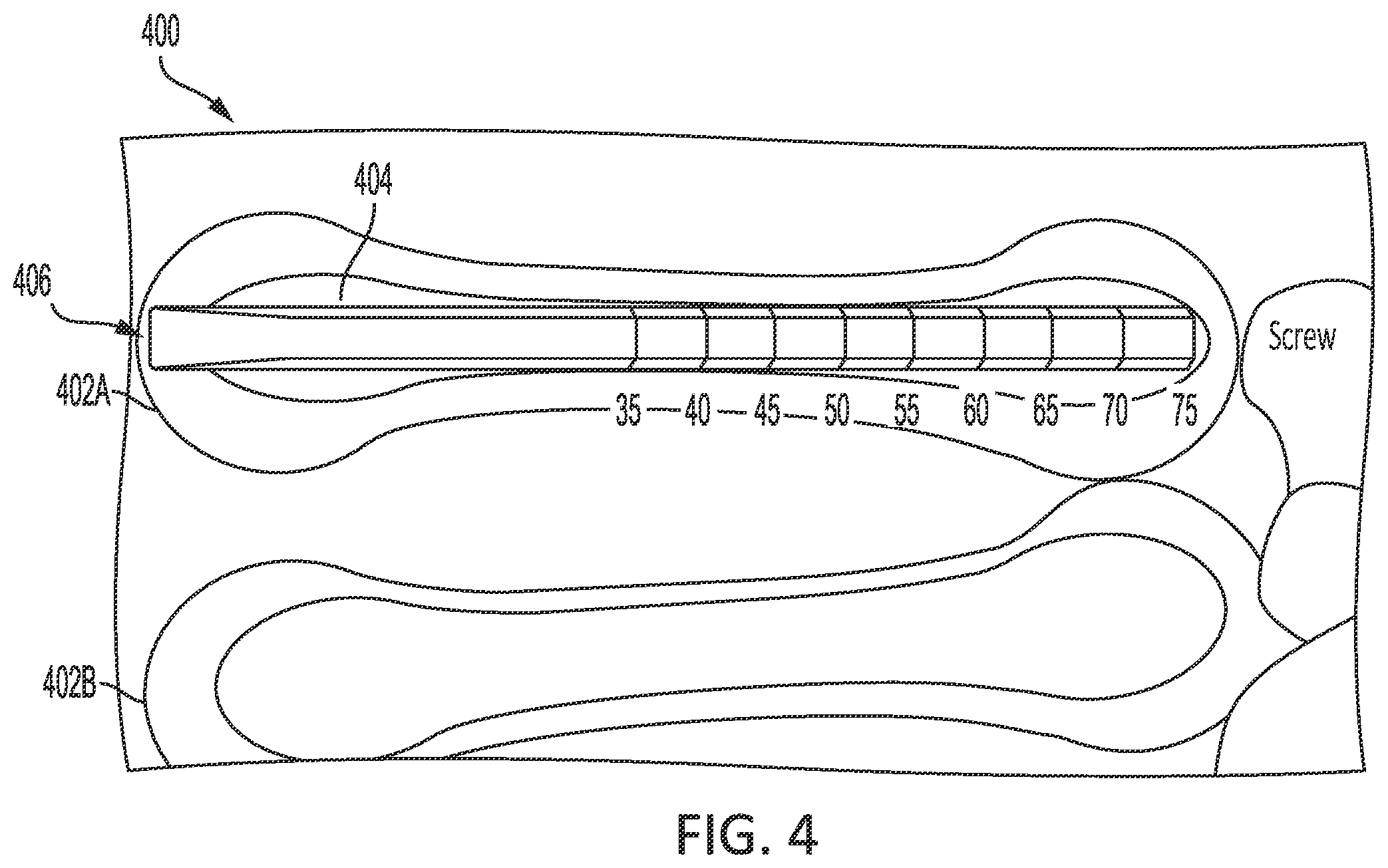 Patent US11793590 Figure 6 – Intramedullary implant screw selection device