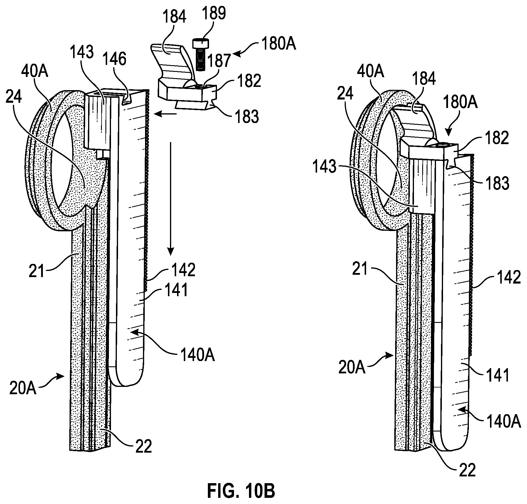Patent US11793592 Figure 16 – Systems and methods for a stereotactic coordinate adjuster