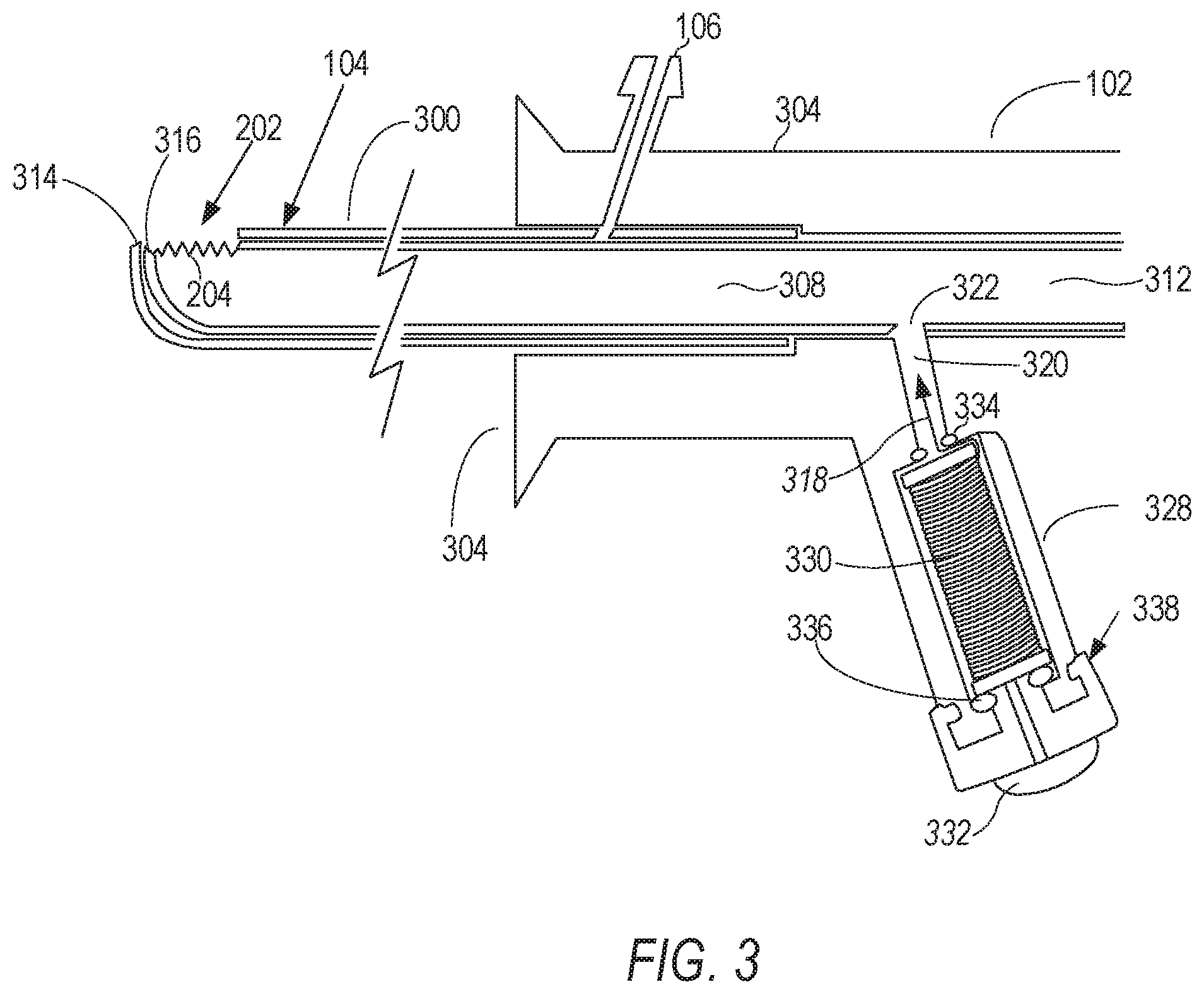Patent US11793600 Figure 3 – Retractable stylet declog mechanism