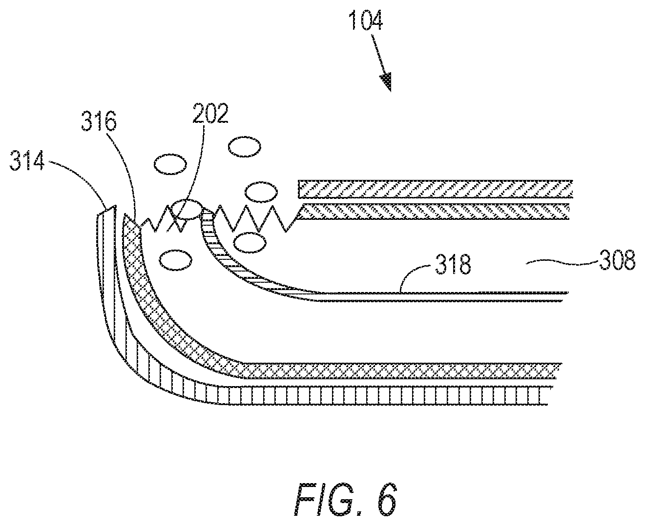 Patent US11793600 Figure 6 – Retractable stylet declog mechanism