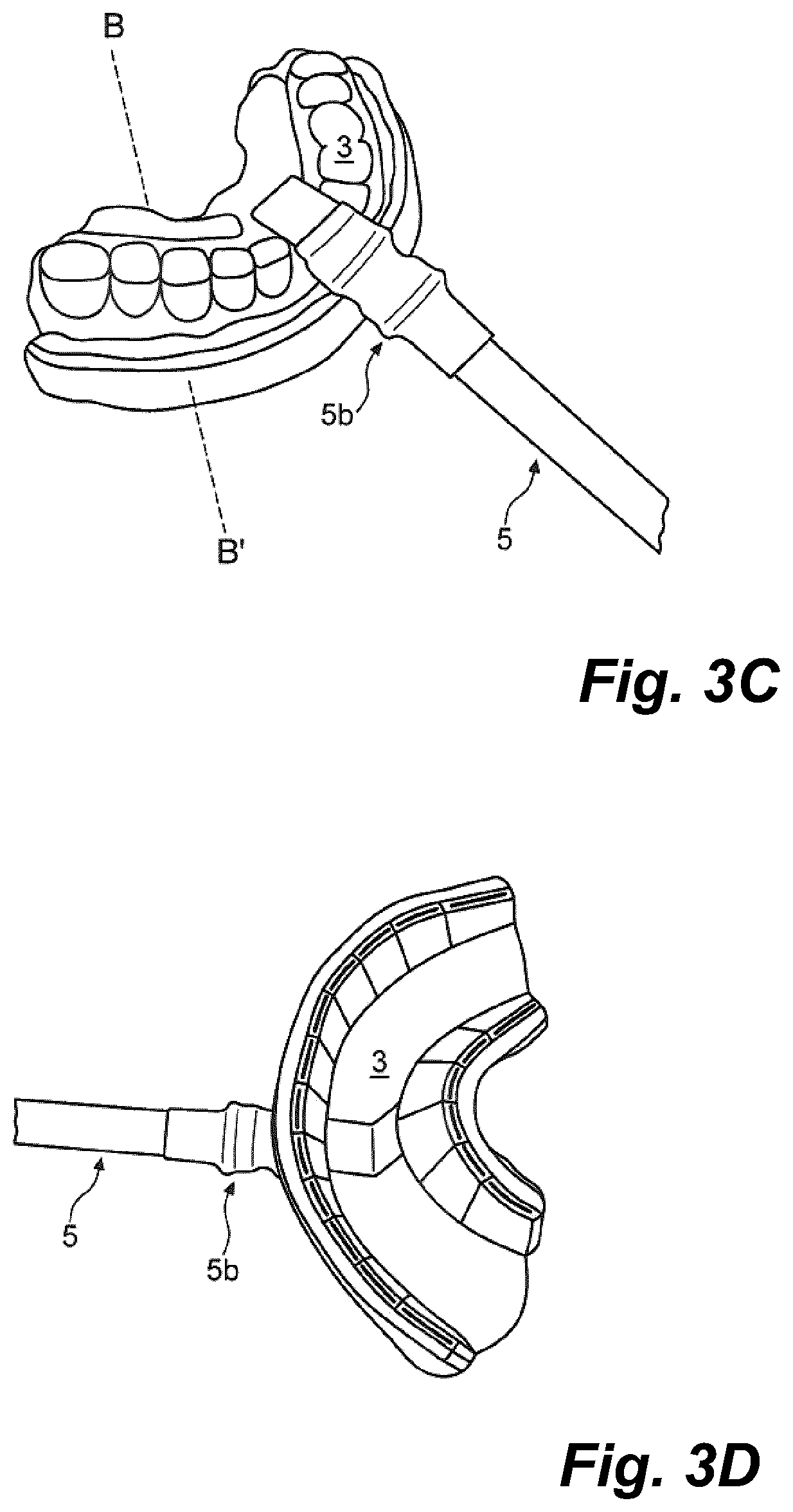Patent US11793604 Figure 3 – Ultrasonic methods and devices for orthodontic treatment with aligners