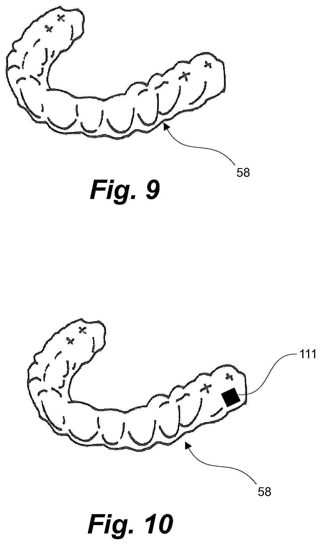 Patent US11793604 Figure 11 – Ultrasonic methods and devices for orthodontic treatment with aligners