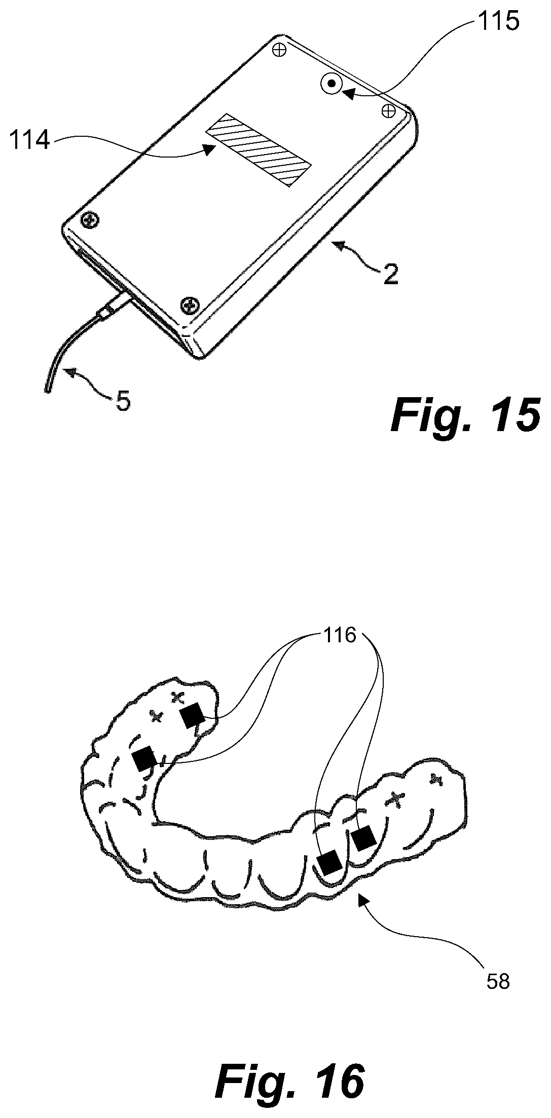 Patent US11793604 Figure 15 – Ultrasonic methods and devices for orthodontic treatment with aligners