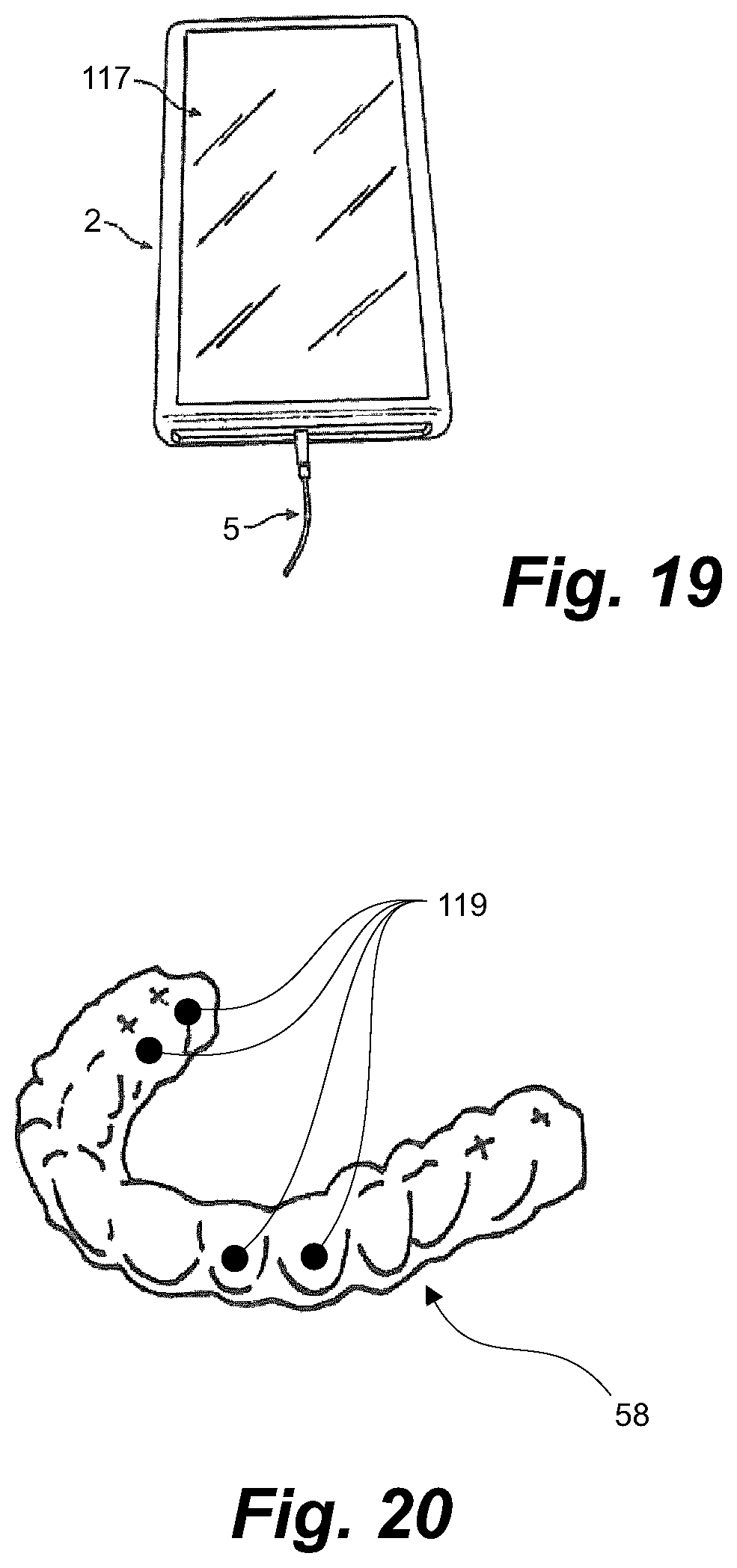 Patent US11793604 Figure 17 – Ultrasonic methods and devices for orthodontic treatment with aligners