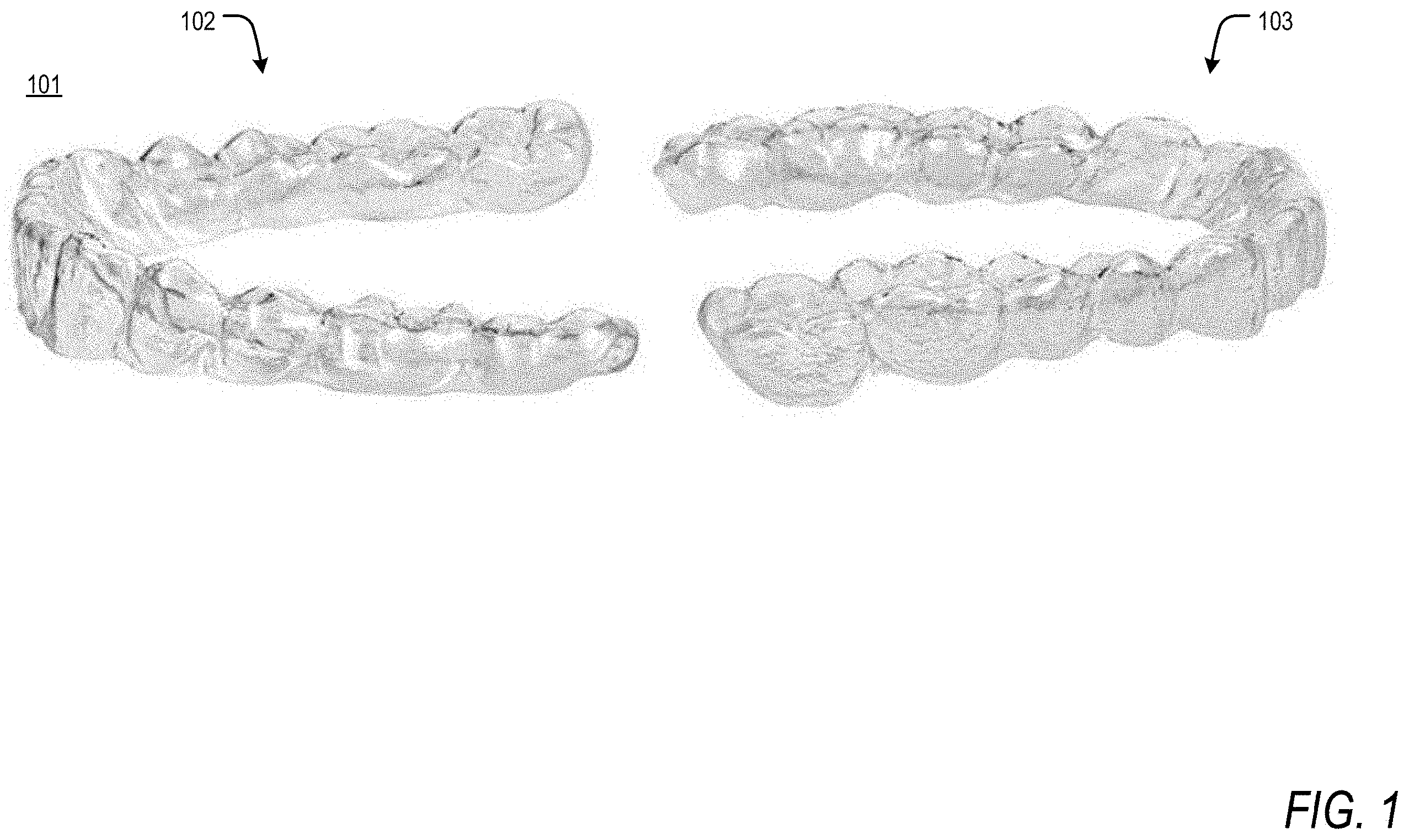 Patent US11793605 Figure 1 – Apparatus and methods for orthodontic treatment planning