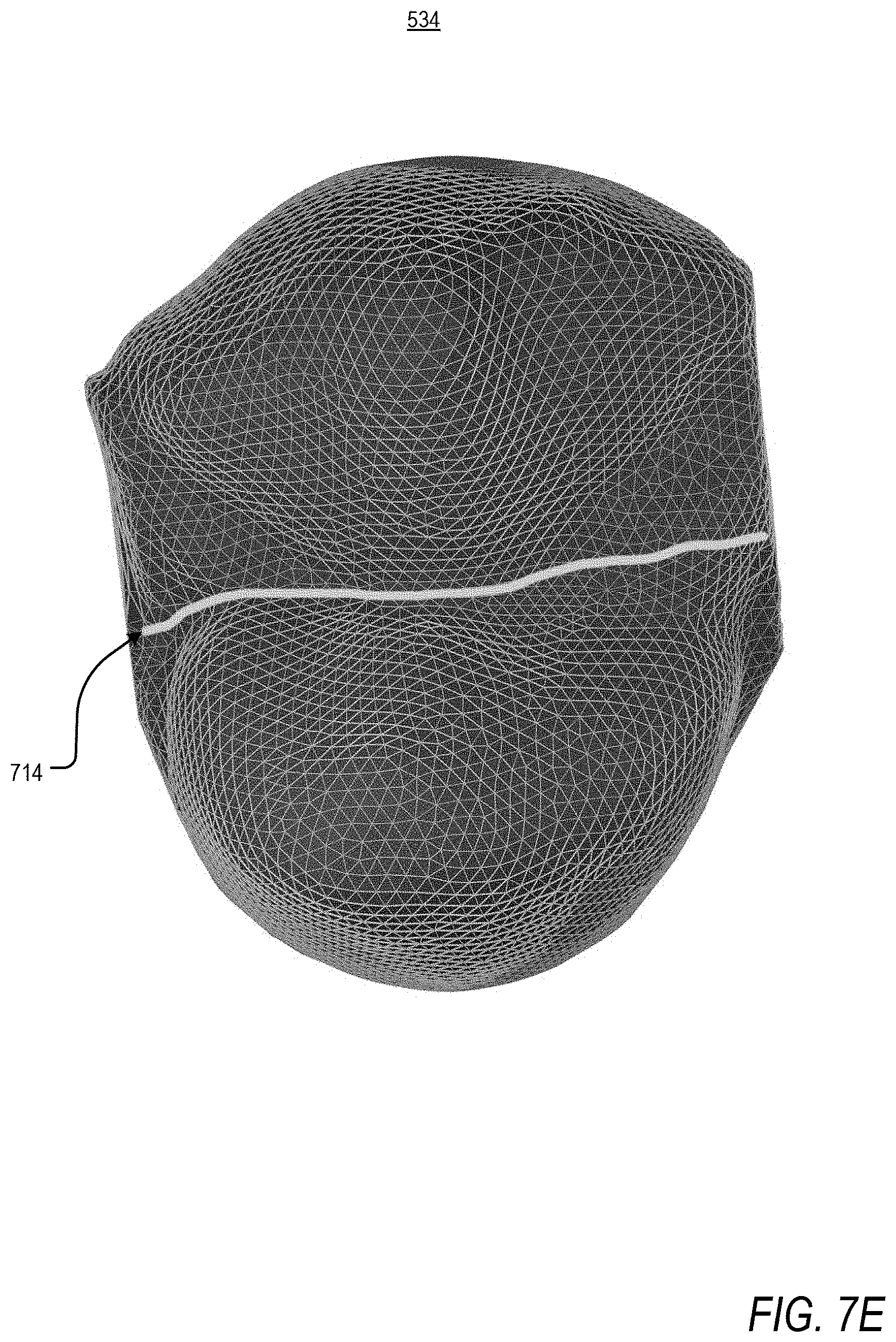 Patent US11793605 Figure 13 – Apparatus and methods for orthodontic treatment planning