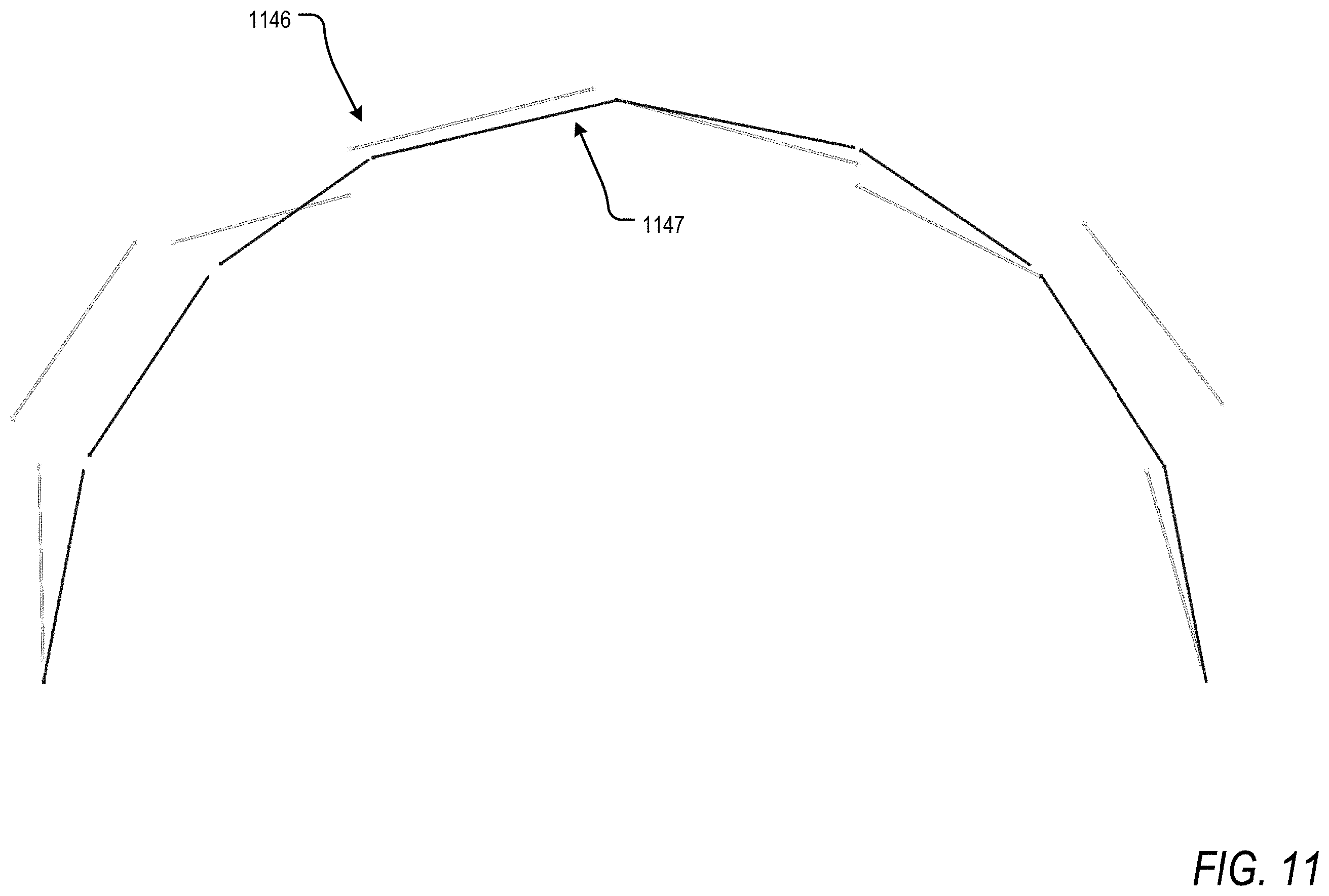 Patent US11793605 Figure 17 – Apparatus and methods for orthodontic treatment planning
