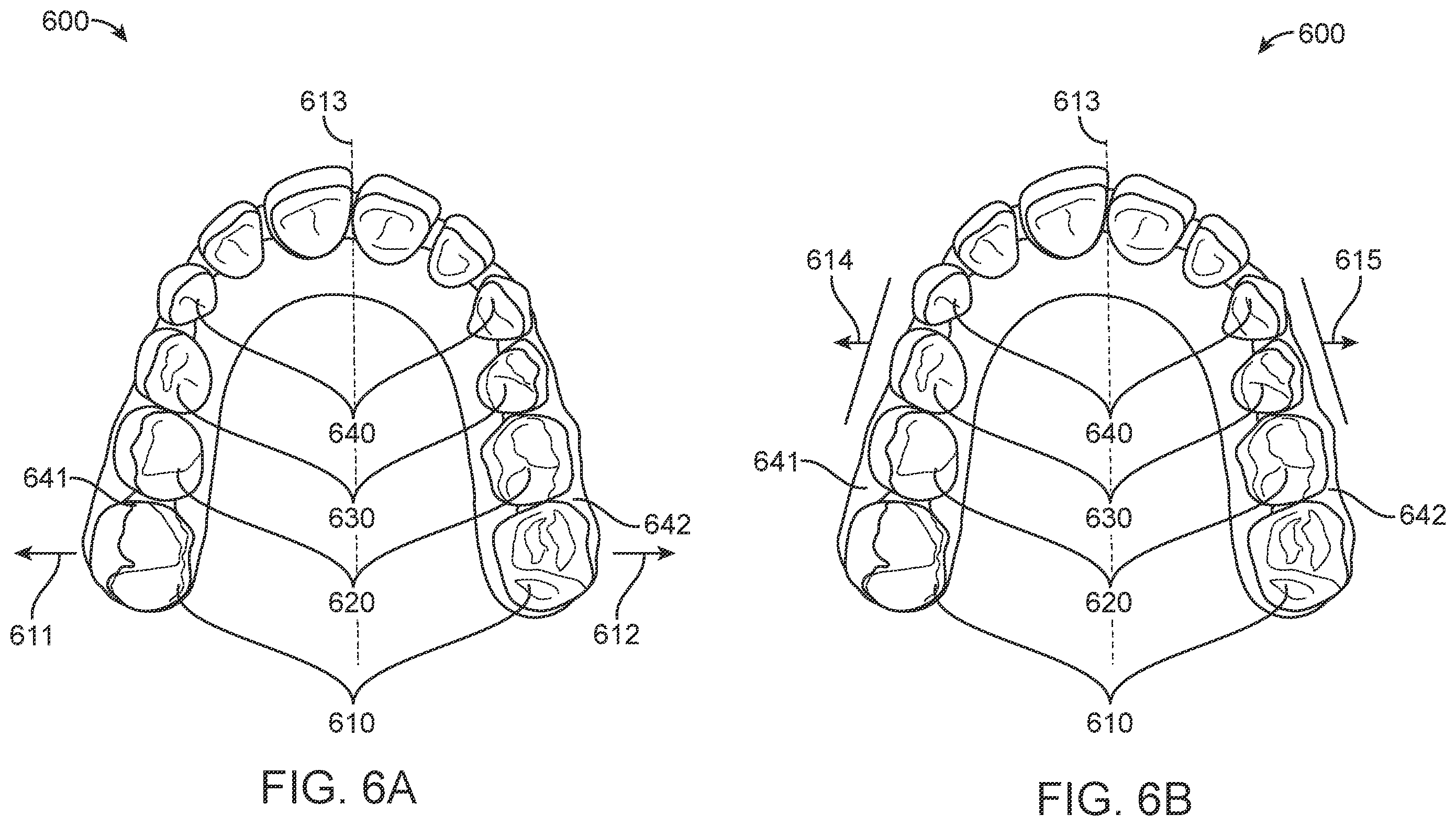 Patent US11793606 Figure 9 – Devices, systems, and methods for dental arch expansion