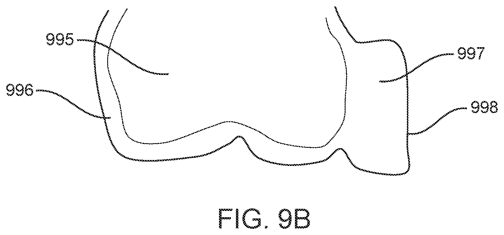 Patent US11793606 Figure 13 – Devices, systems, and methods for dental arch expansion