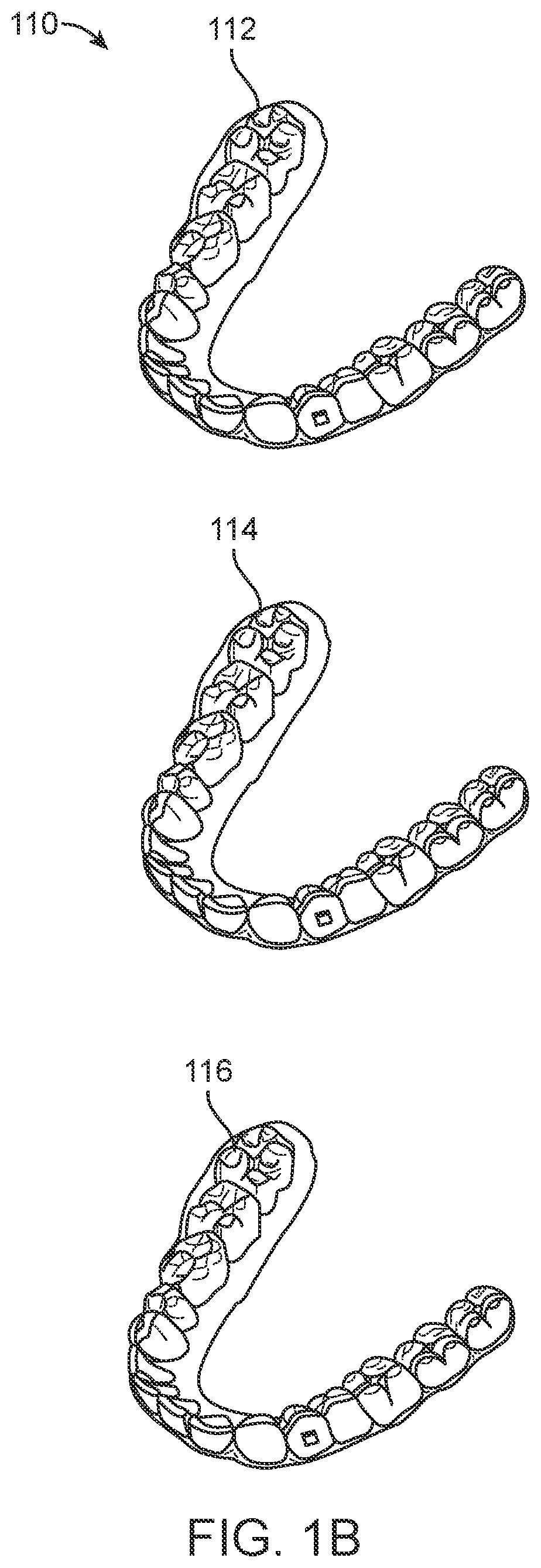 Patent US11793608 Figure 2 – Systems and methods for correcting malocclusions of teeth