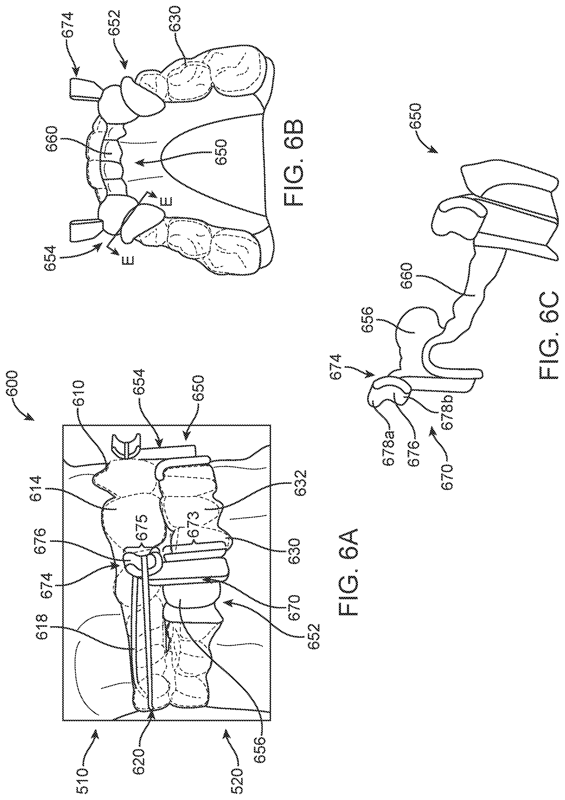 Patent US11793608 Figure 8 – Systems and methods for correcting malocclusions of teeth