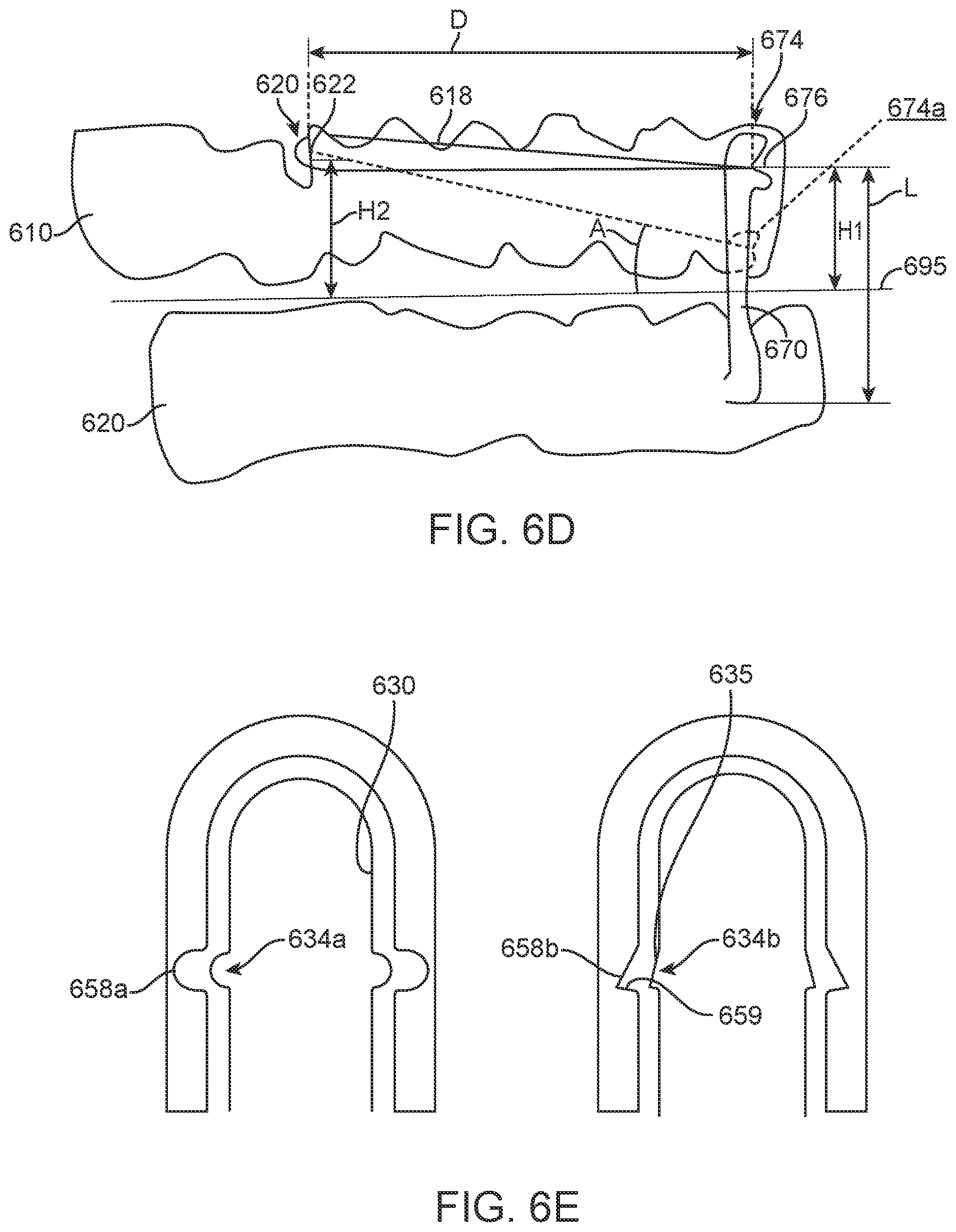 Patent US11793608 Figure 9 – Systems and methods for correcting malocclusions of teeth
