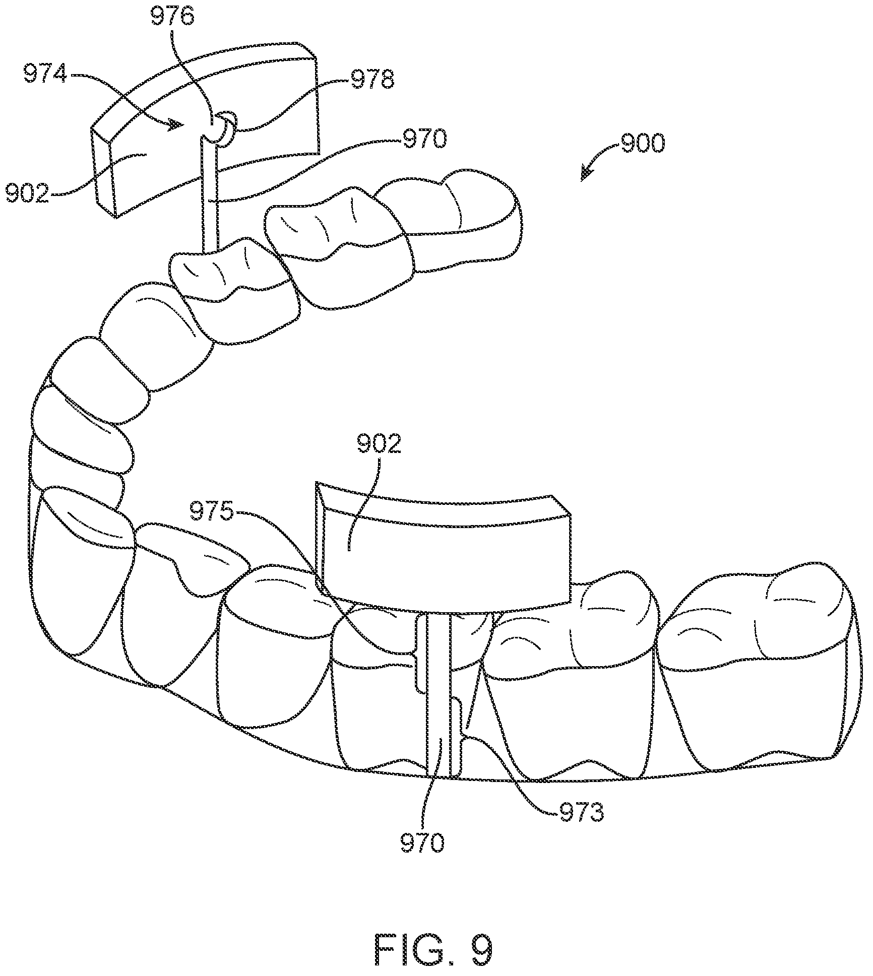 Patent US11793608 Figure 12 – Systems and methods for correcting malocclusions of teeth