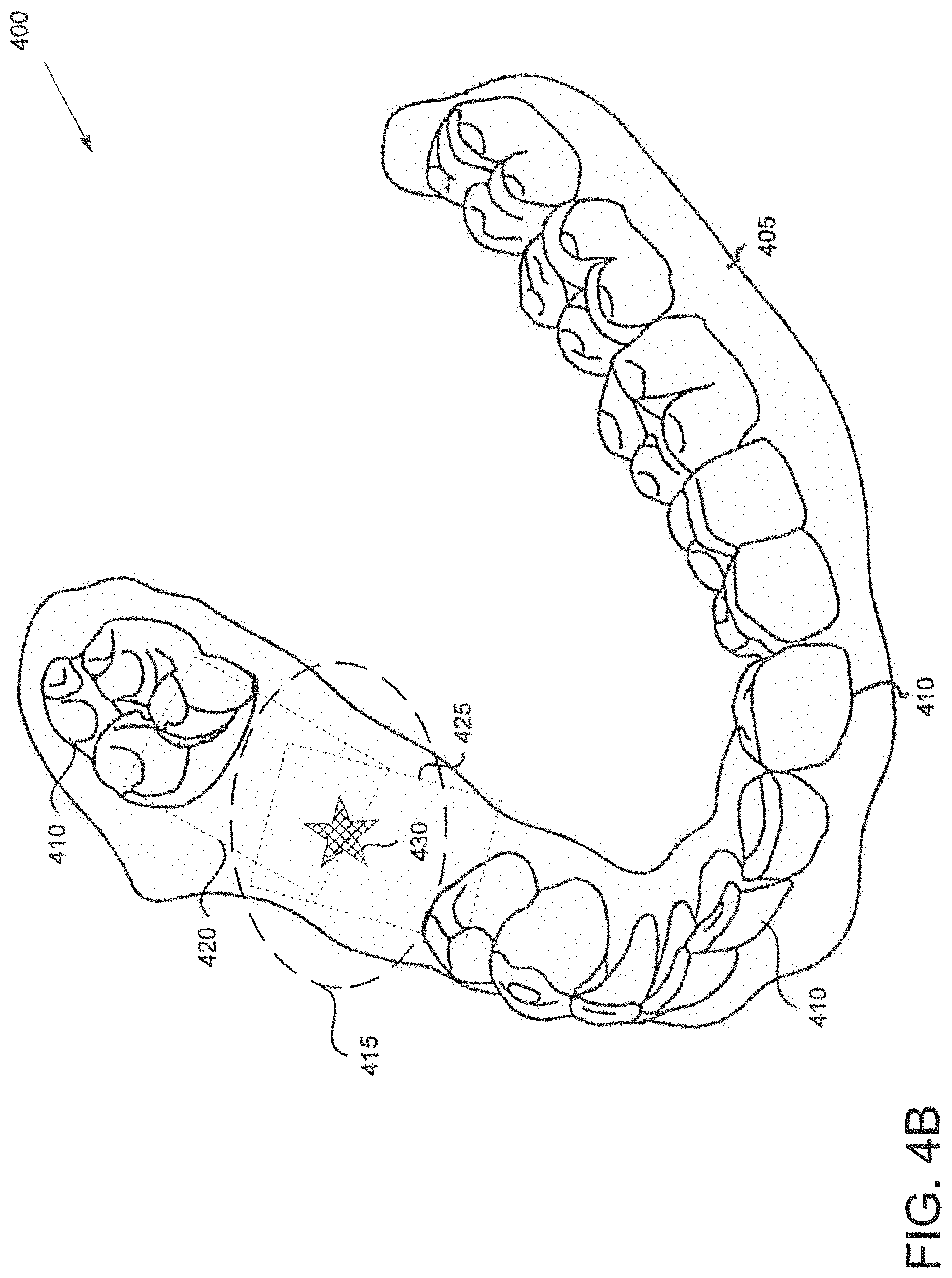 Patent US11793610 Figure 5 – Image registration of intraoral images using non-rigid indicia