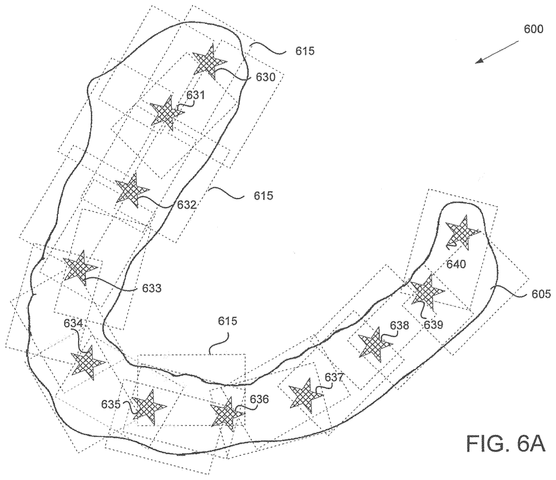 Patent US11793610 Figure 10 – Image registration of intraoral images using non-rigid indicia