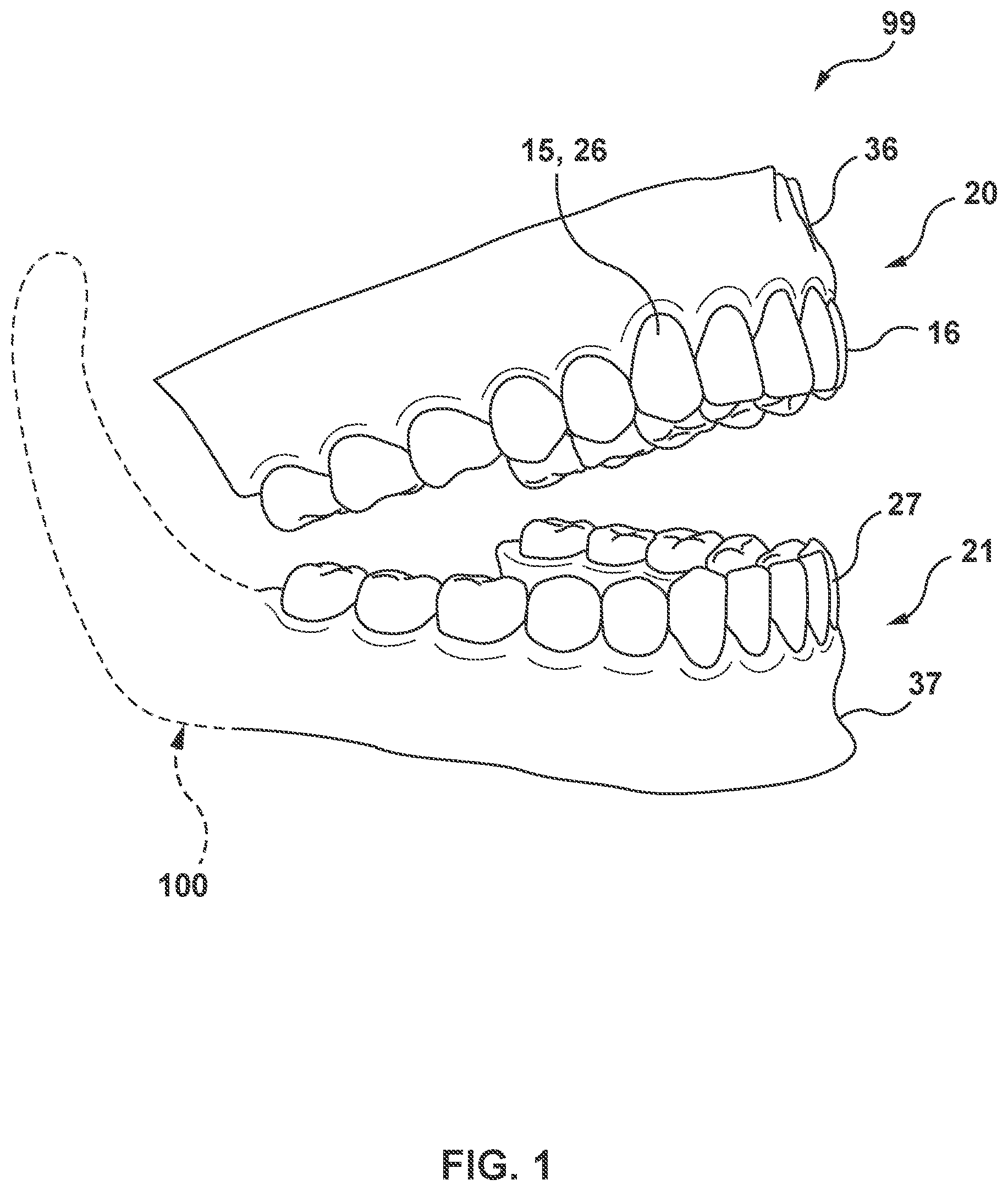 Patent US11793612 Figure 1 – Methods and systems for modeling mandibular motion