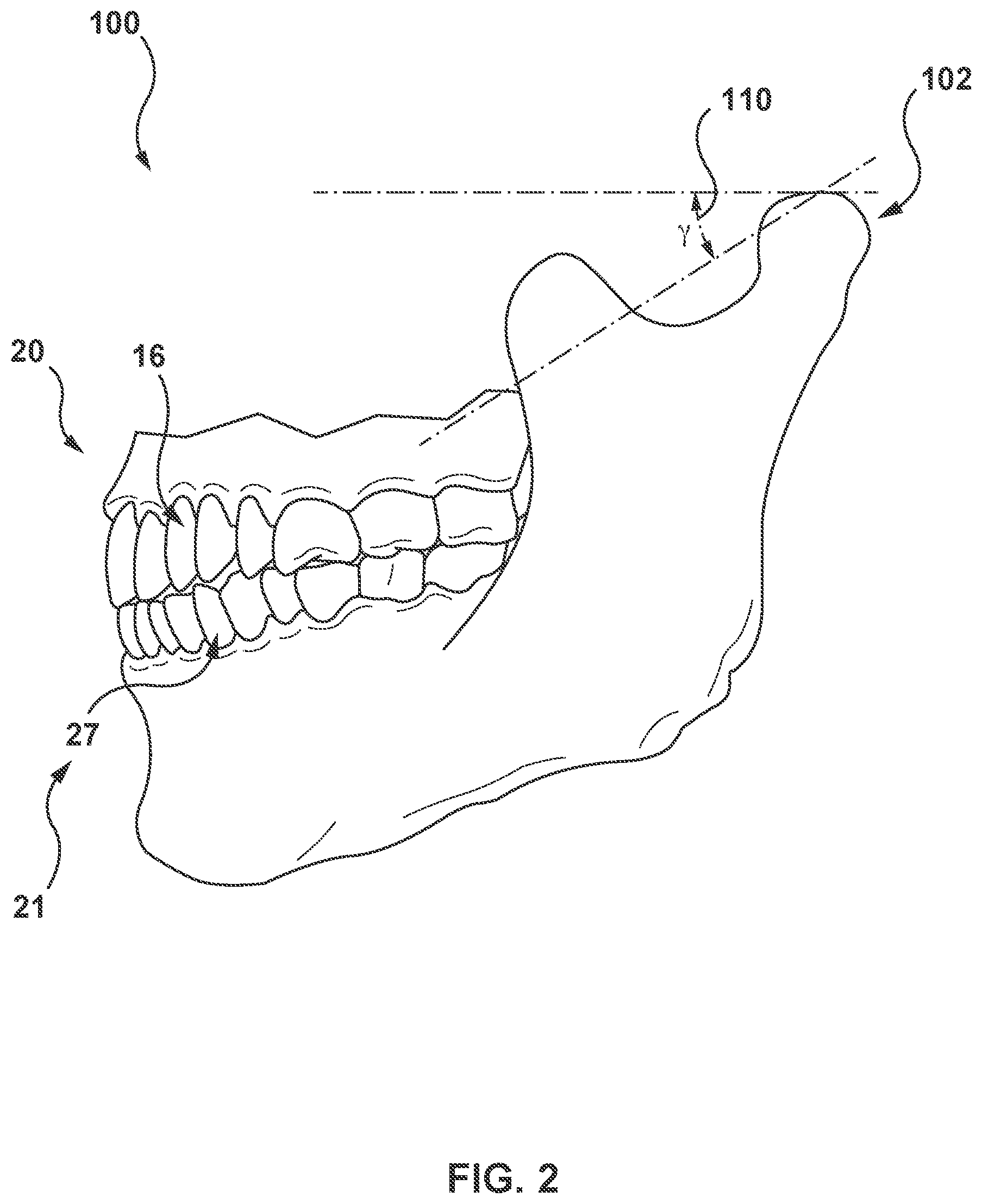 Patent US11793612 Figure 2 – Methods and systems for modeling mandibular motion