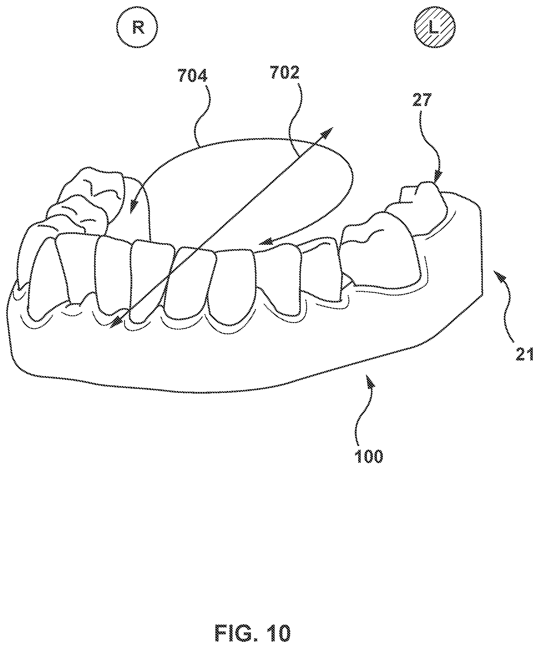 Patent US11793612 Figure 8 – Methods and systems for modeling mandibular motion