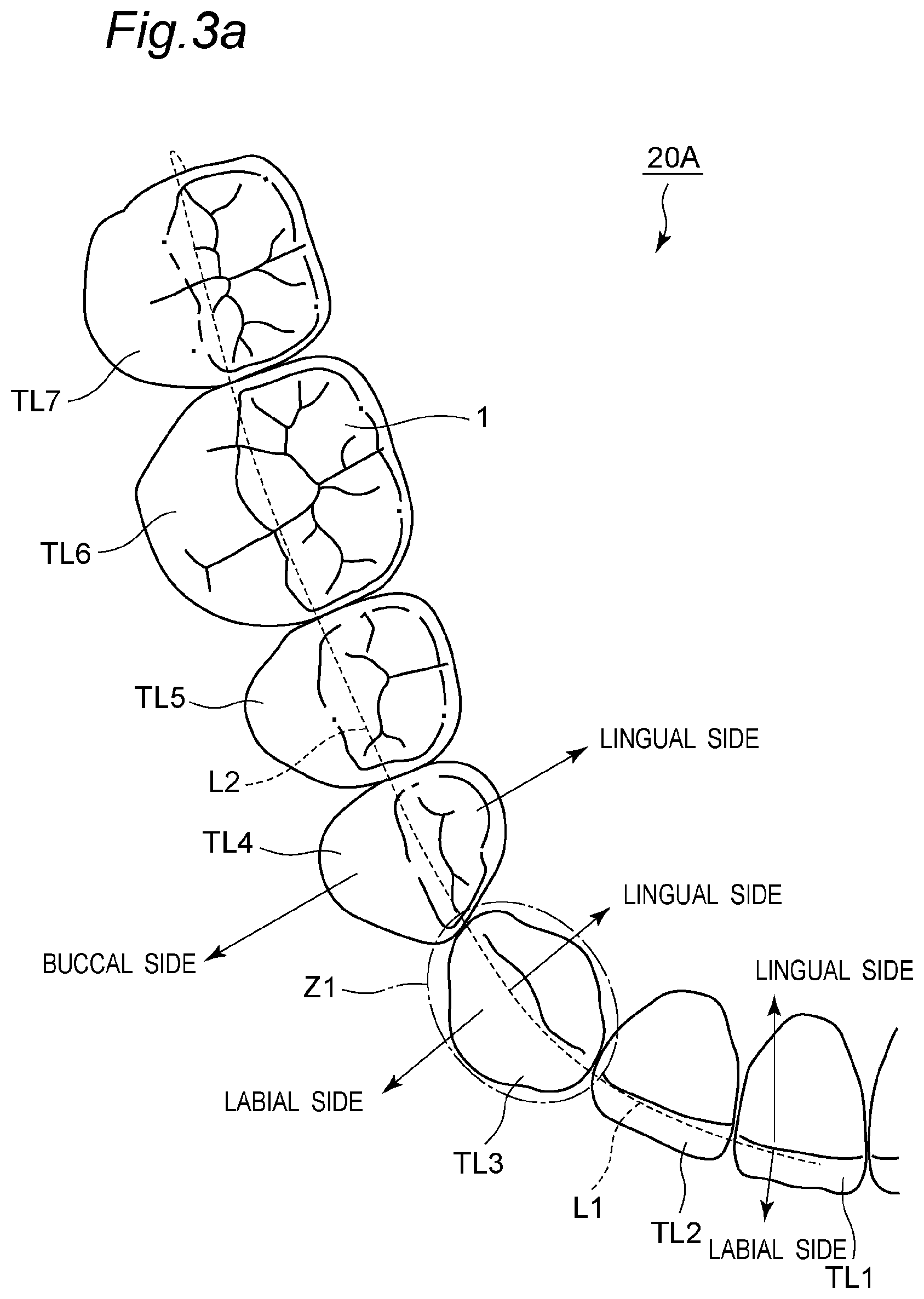 Patent US11793614 Figure 3 – Method for producing denture with high accuracy of fitting of artificial tooth to socket
